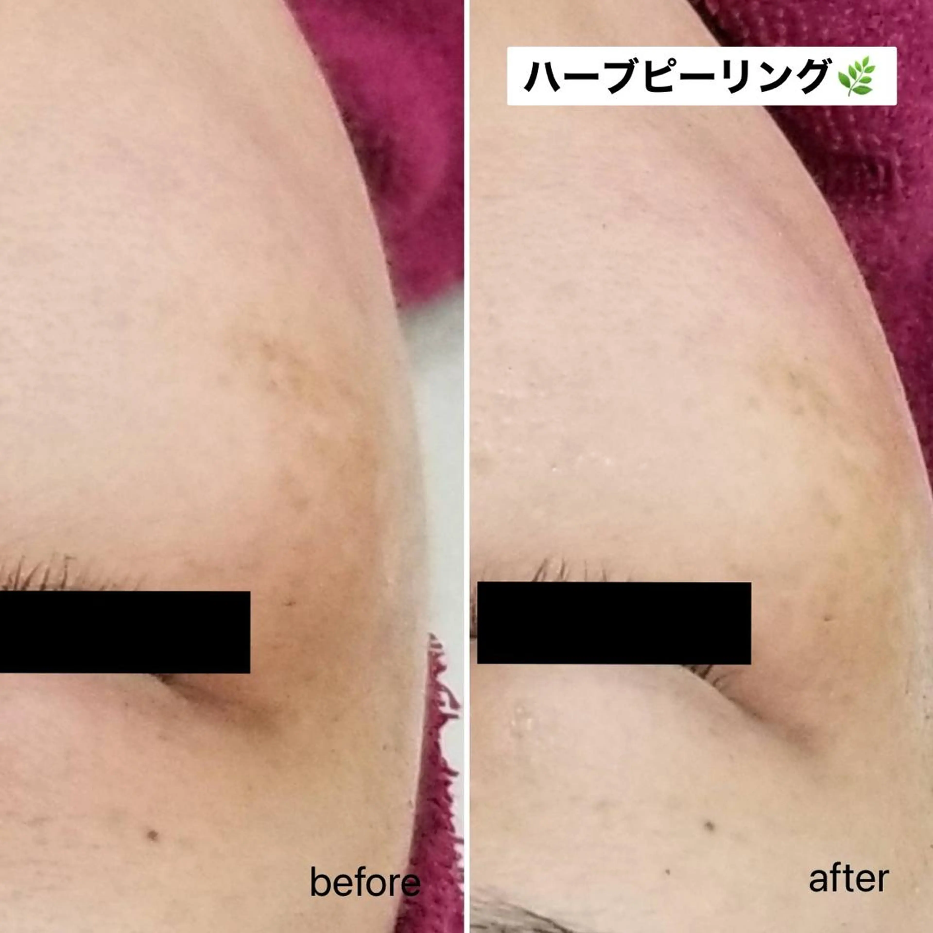 エステ 美肌脱毛&毛穴専門 Anaciaのエステ・リラクイメージ