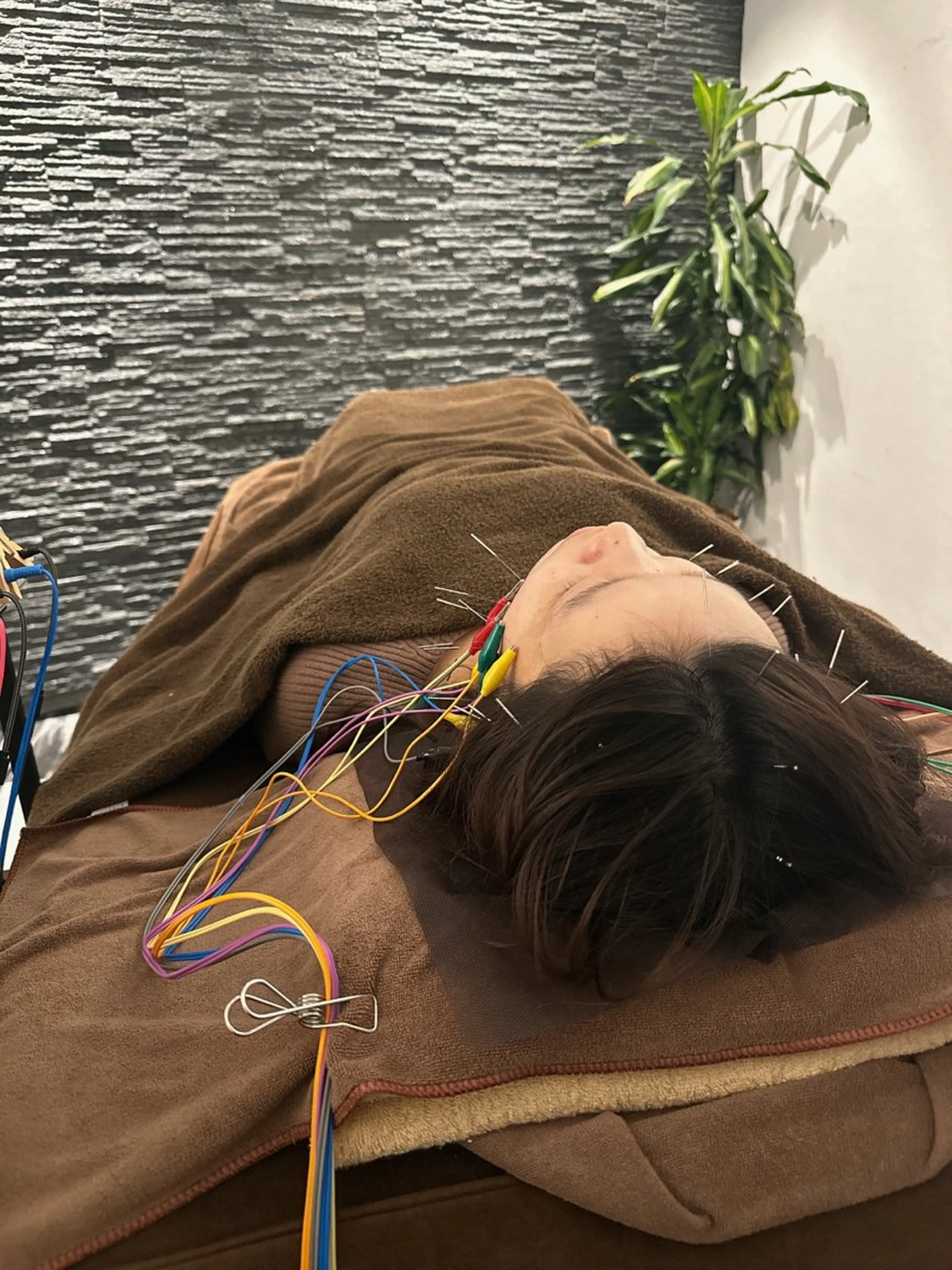 その他 美容鍼灸整体サロンBeauJu所属・小顔矯/美容鍼/鍼灸 BeauJuのその他イメージ