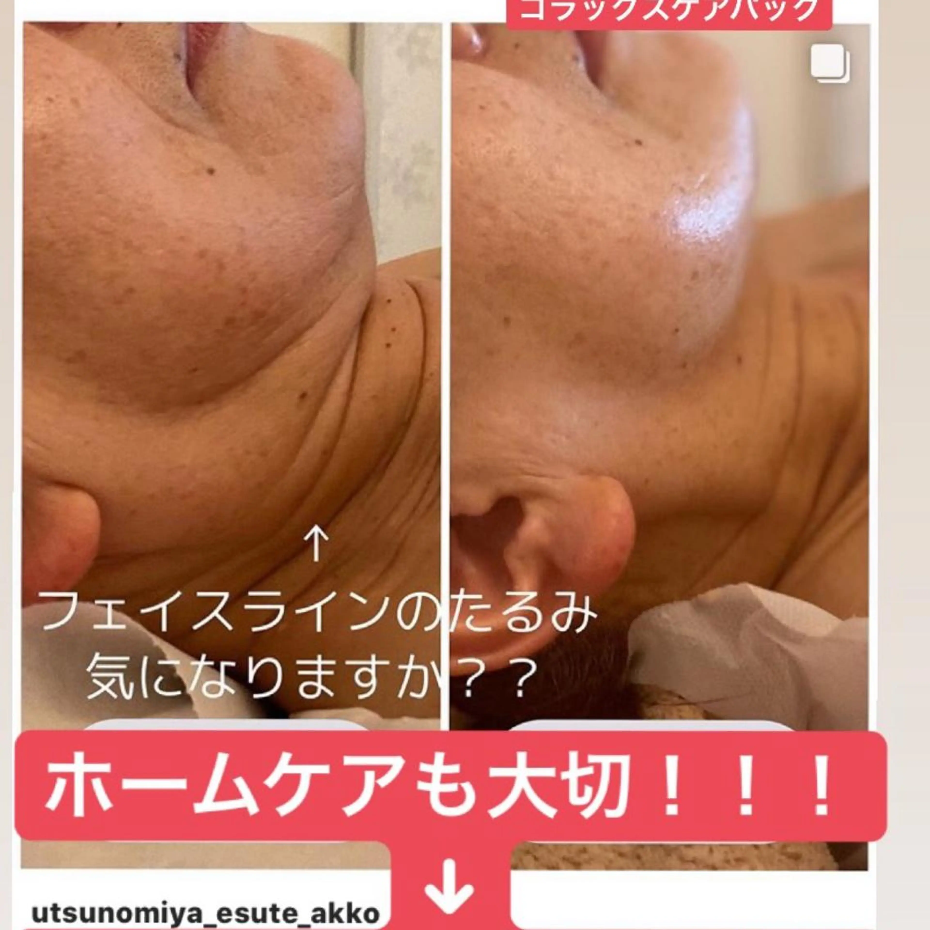 お試し　スタンダード＋エイジングケアコース　　　　　　　　肩のマッサージしっかり　お顔も小顔　リフトアップするコースですの写真