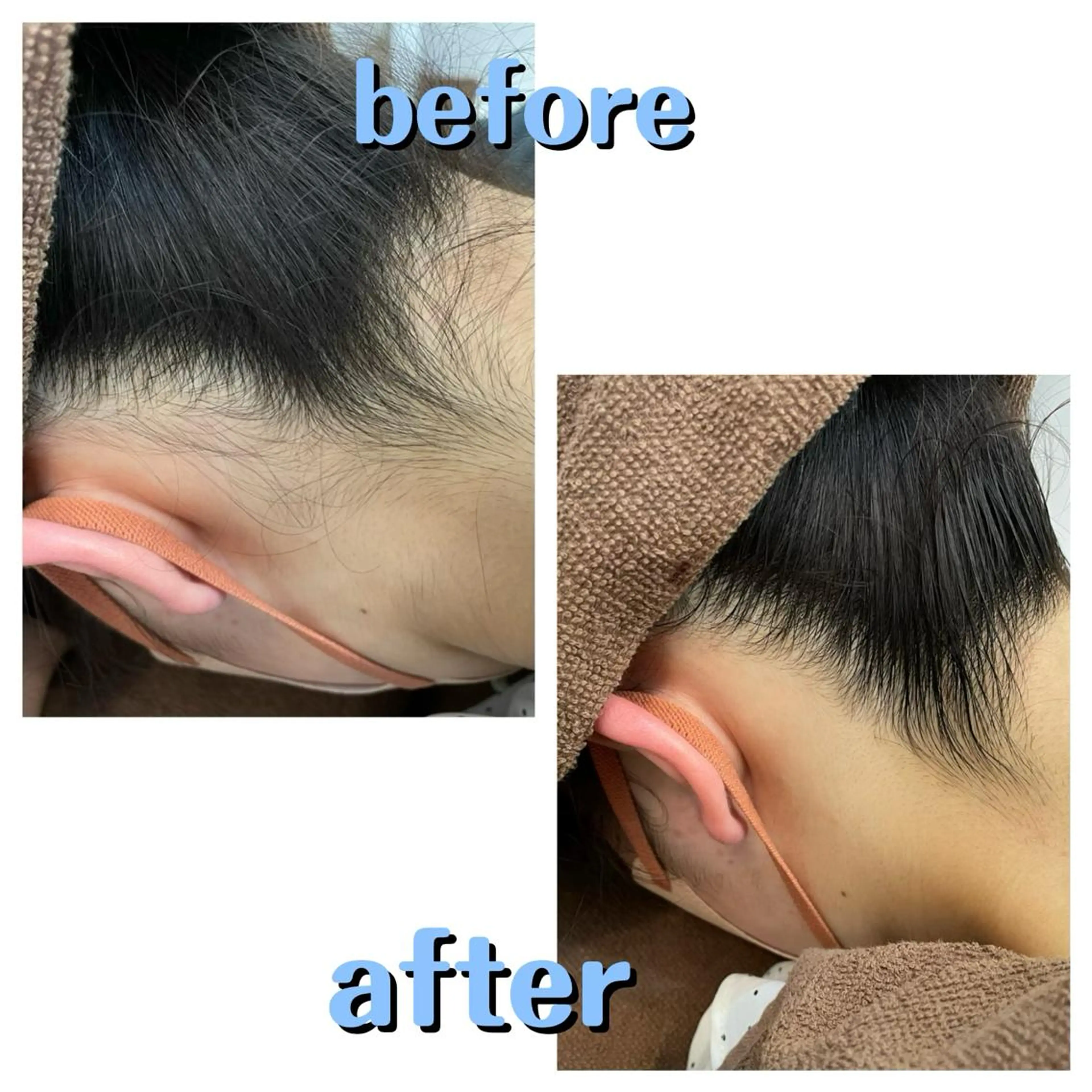 脱毛 salonde ReGodのエステ・リラクイメージ