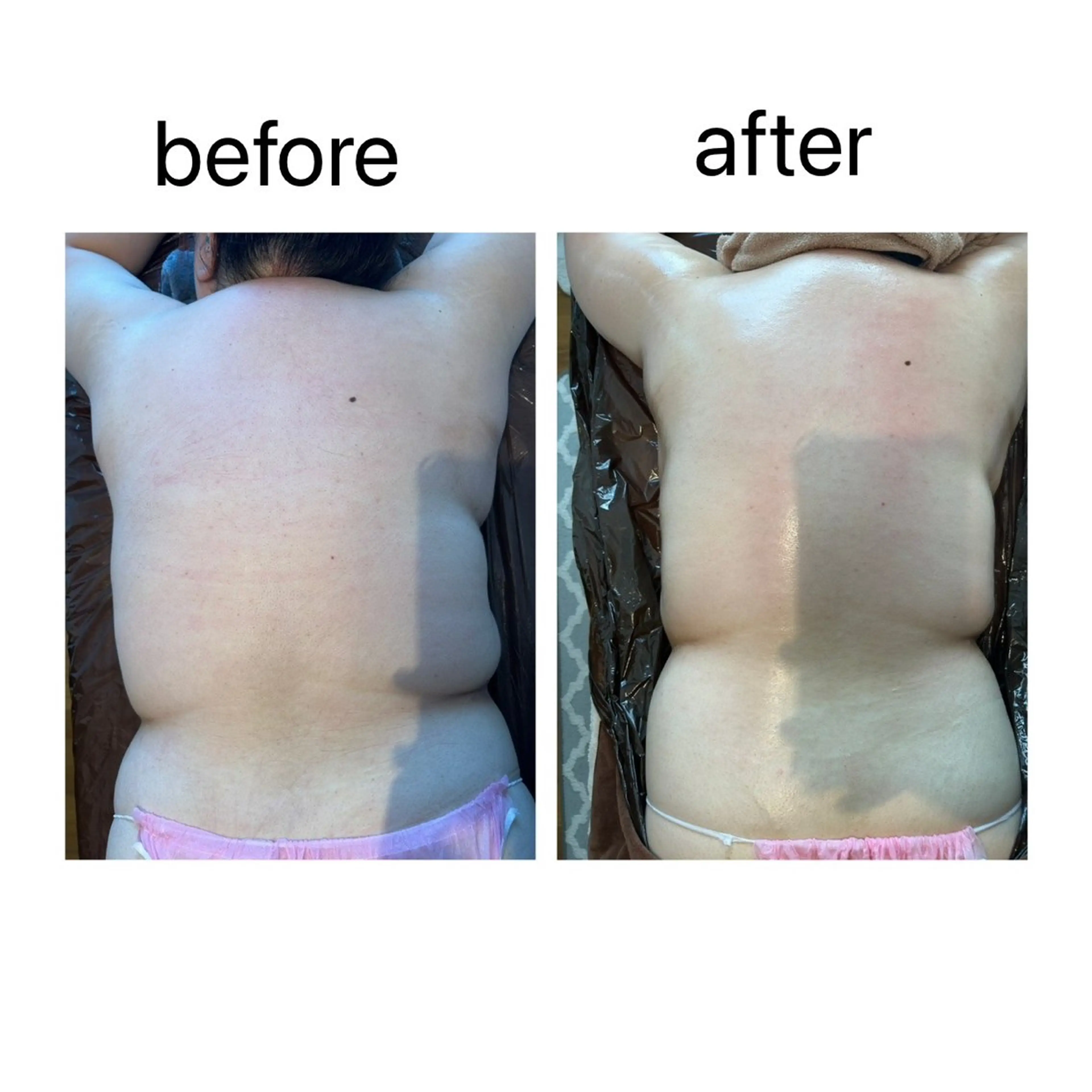 ダイエットの味方！痩身リンパトリートメント90分の写真