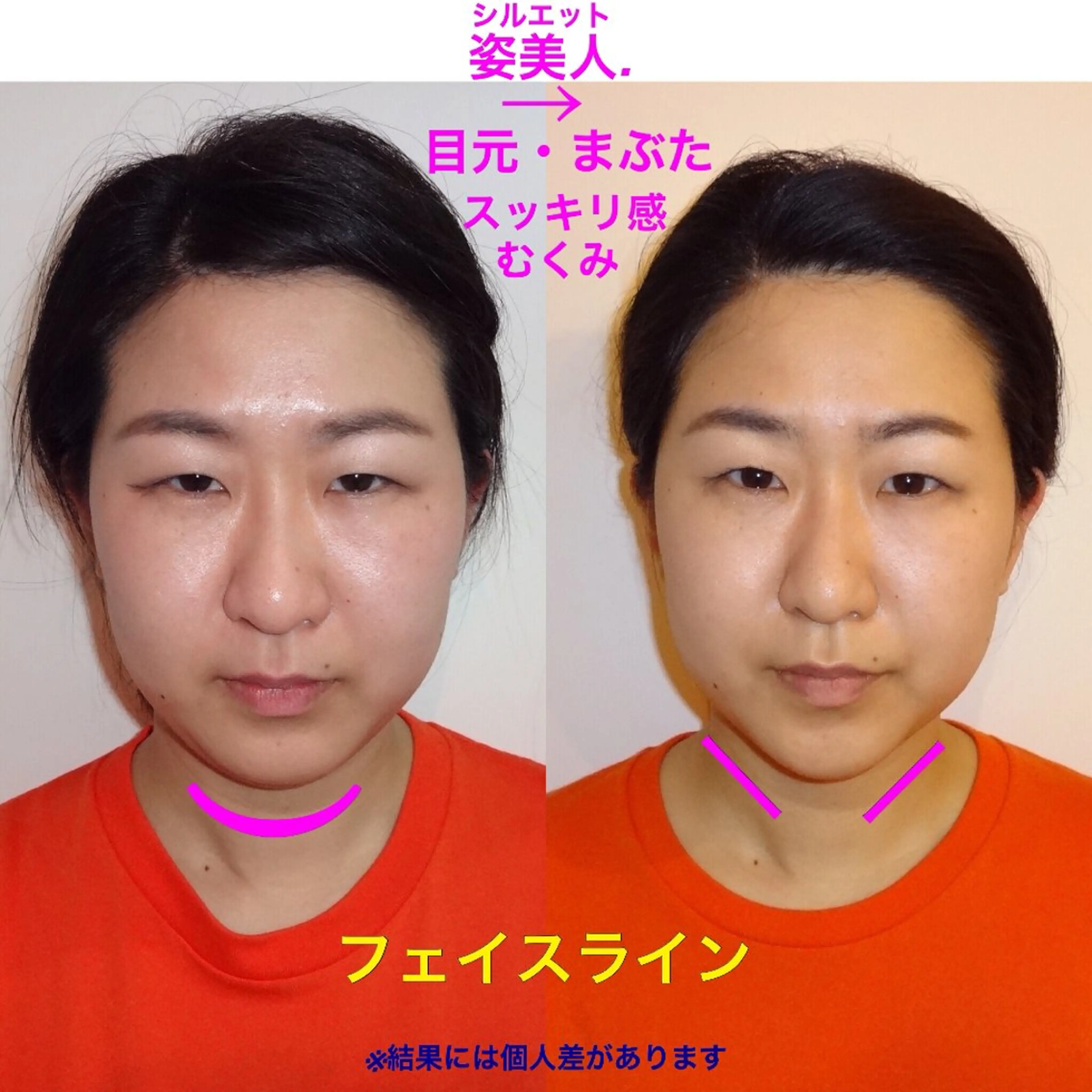 筋膜整体＆小顔矯正 　姿美人.シルエットのエステ・リラクイメージ