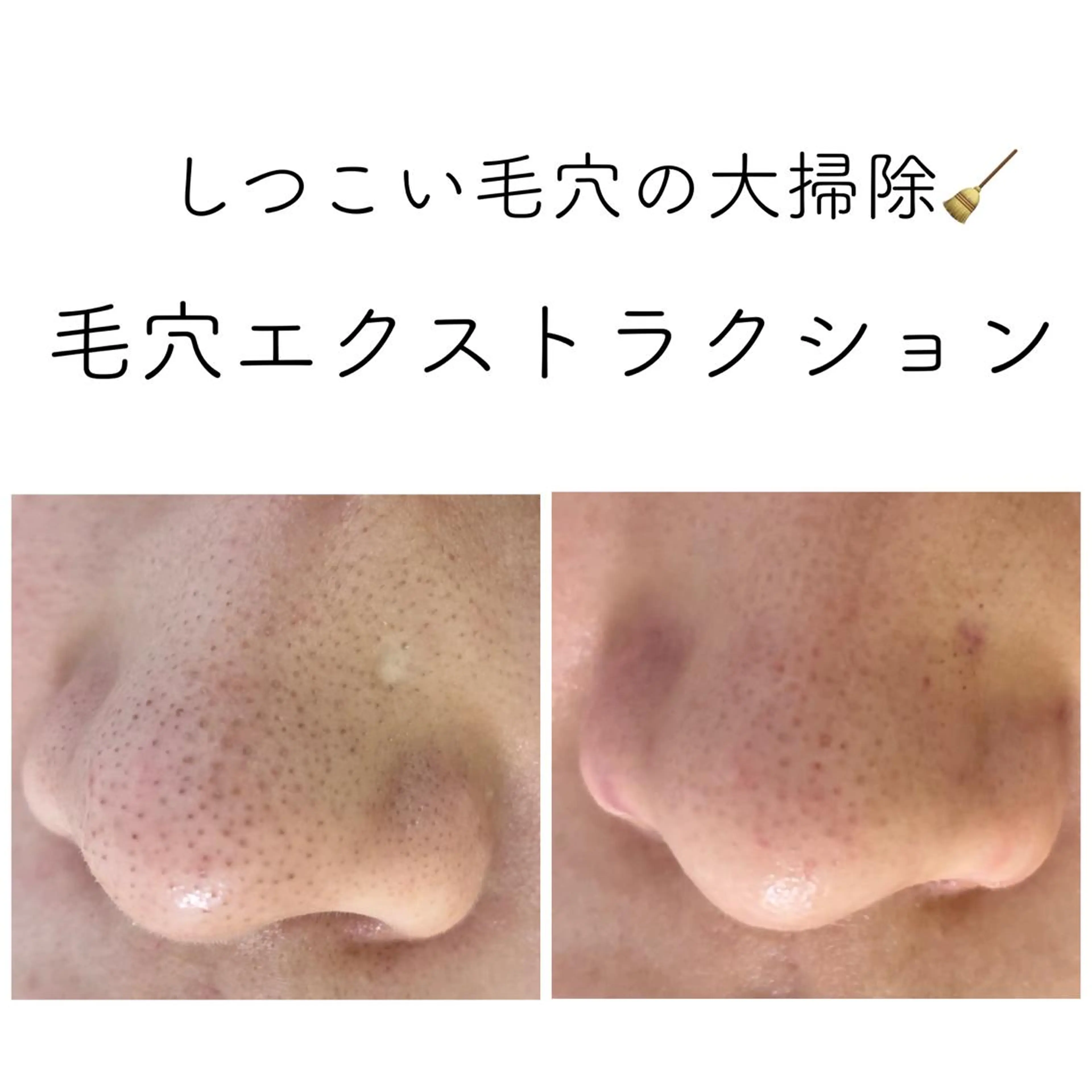 エステ ニキビ&跡改善サロン オーナー光木のエステ・リラクイメージ