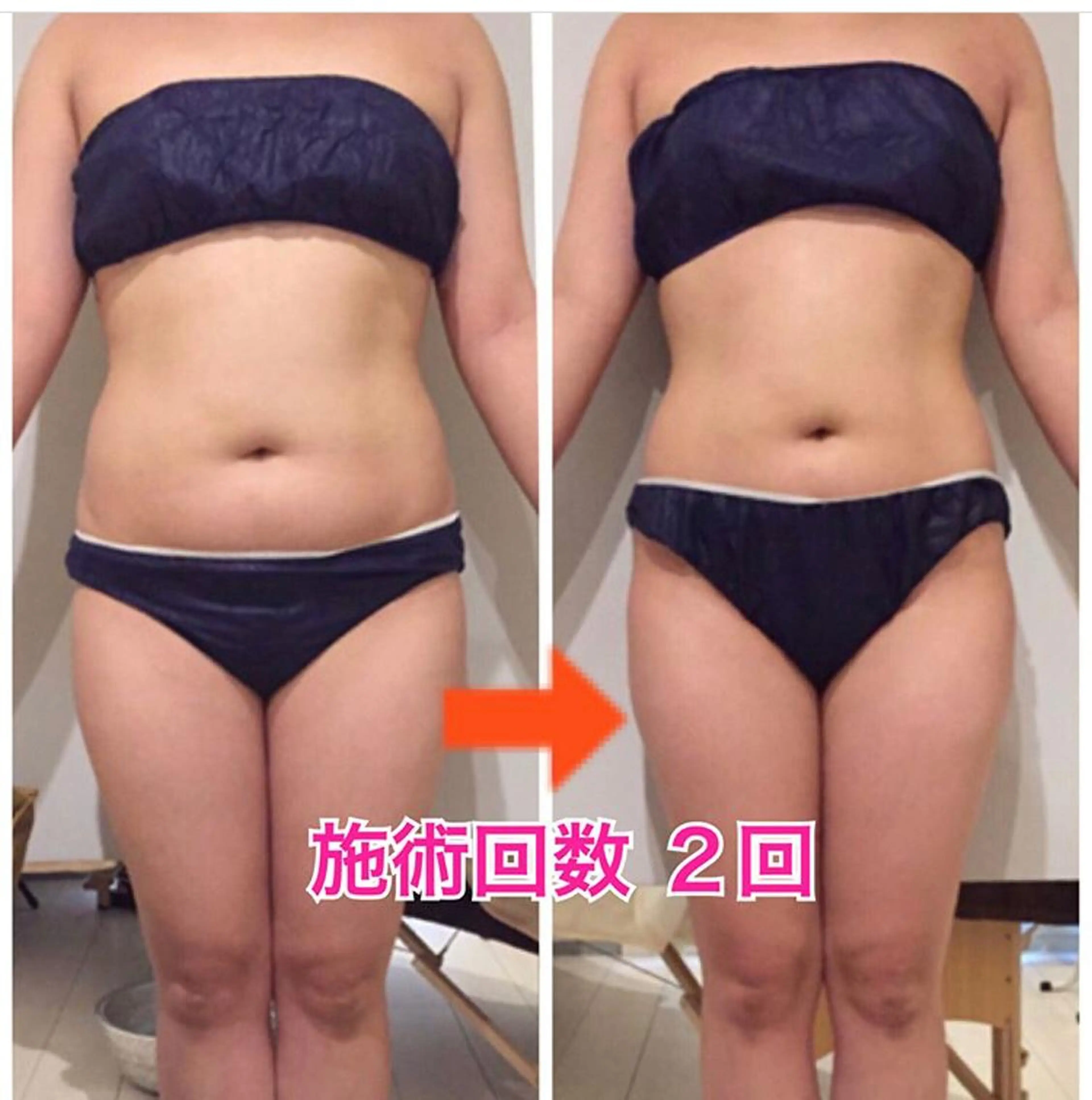 ロング カラー パーマ ヘアアレンジ メンズ キッズ ネイル マツエク・マツパ ‍痩身＆ボディ 結果出し🌟丹野のエステ・リラクイメージ