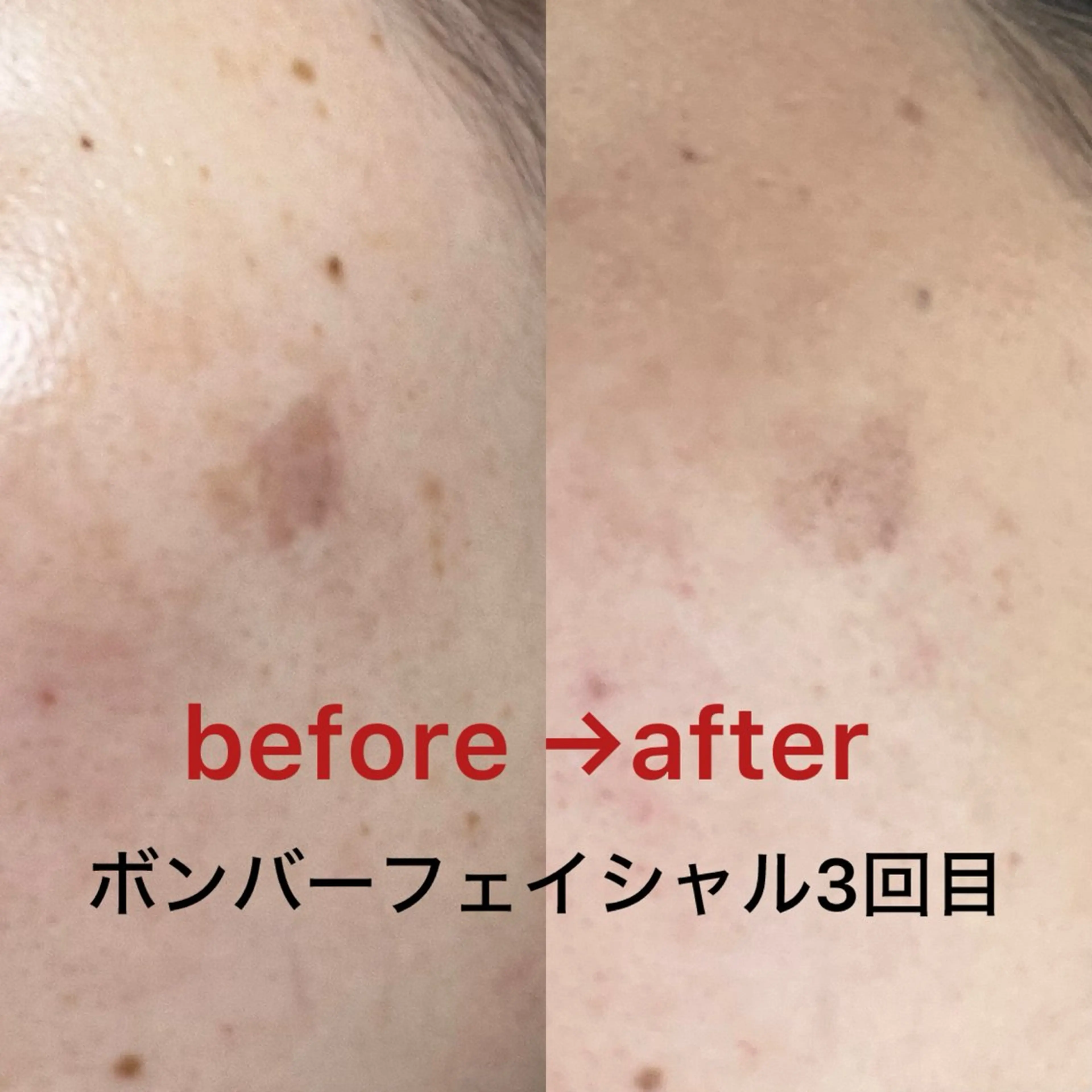 エステ La BeIIe vie所属・LaBeIIevie ラベルヴィのマツエク・マツパデザイン