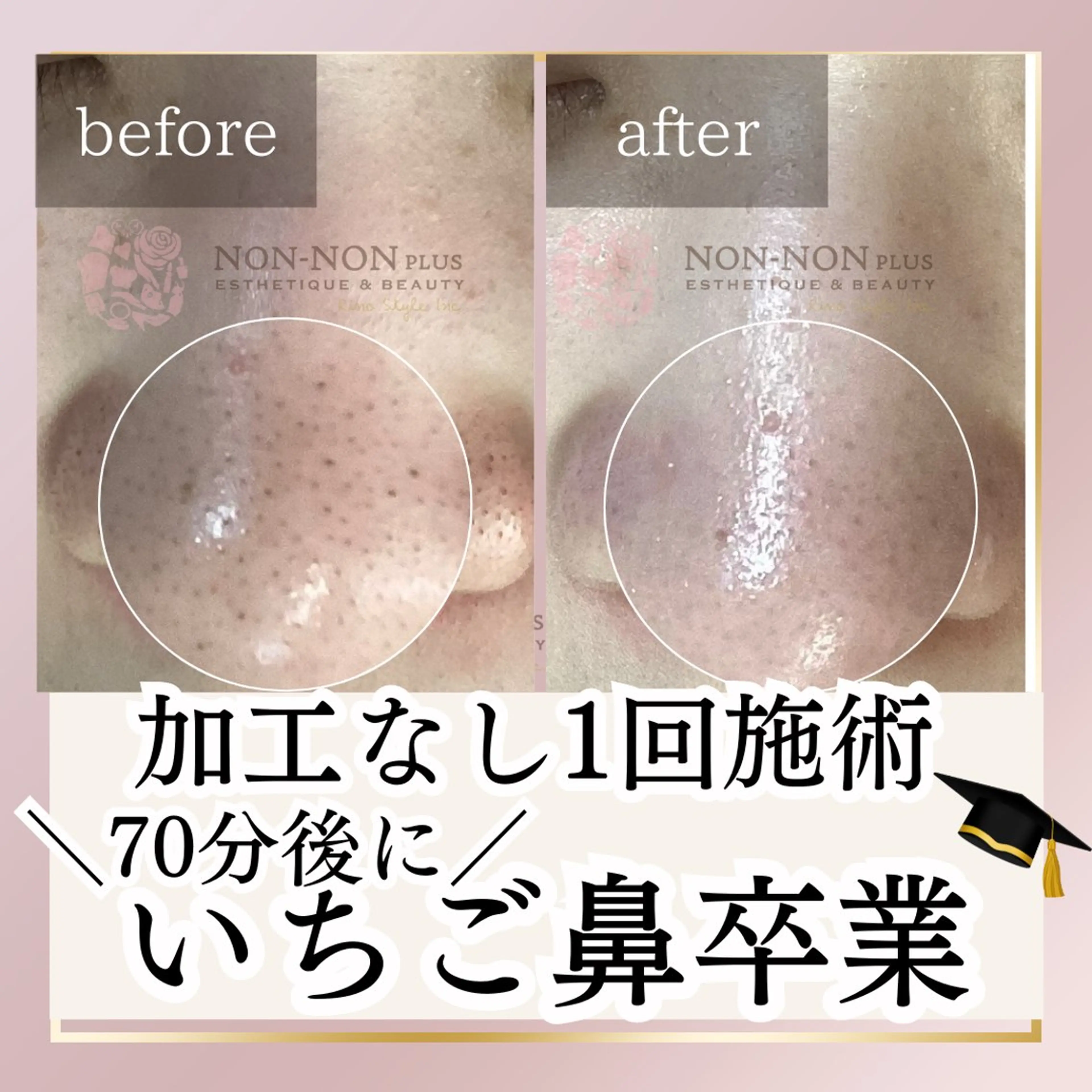 エステ NON-NONプラス 大人の本気痩身のエステ・リラクイメージ