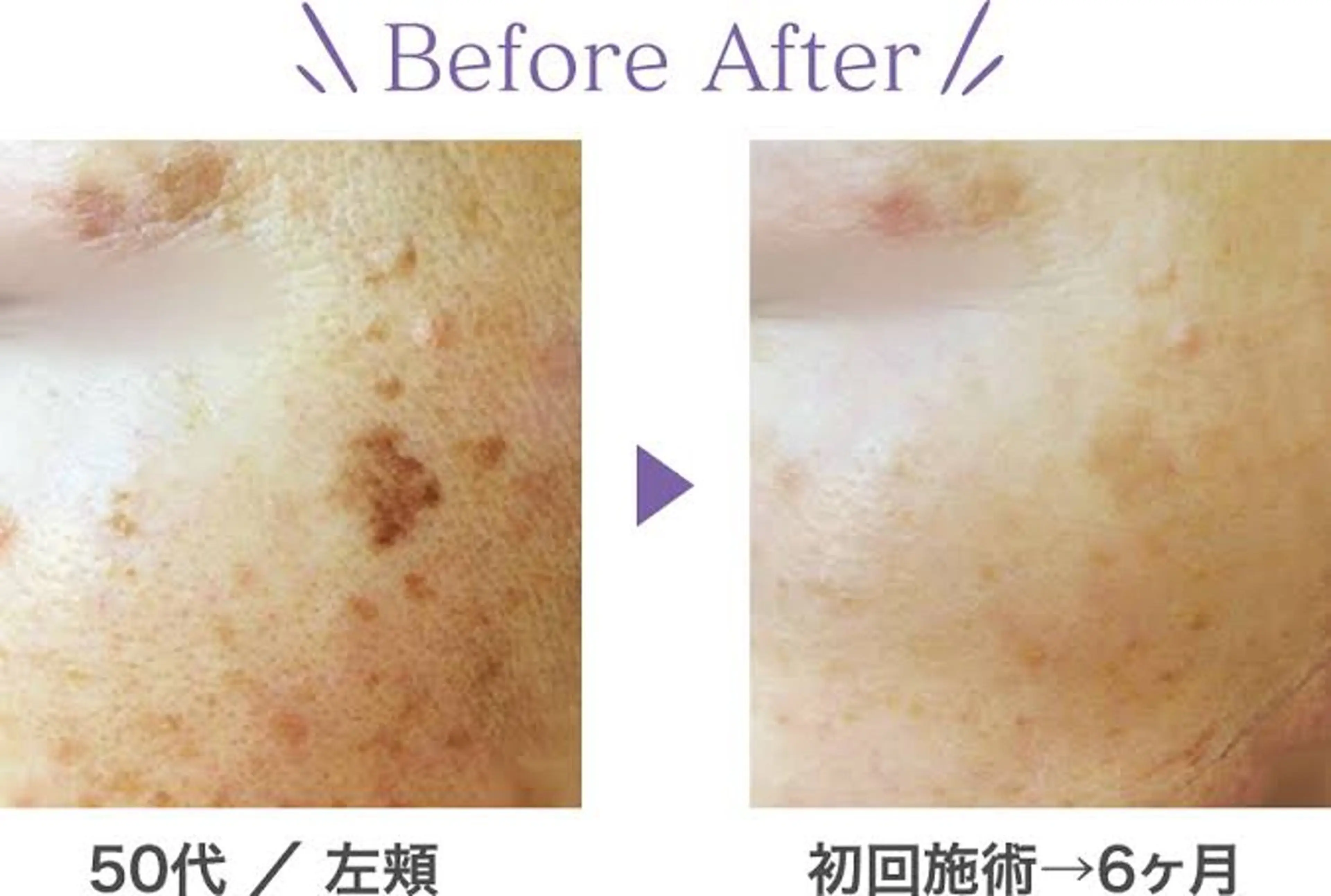 シミケアの写真