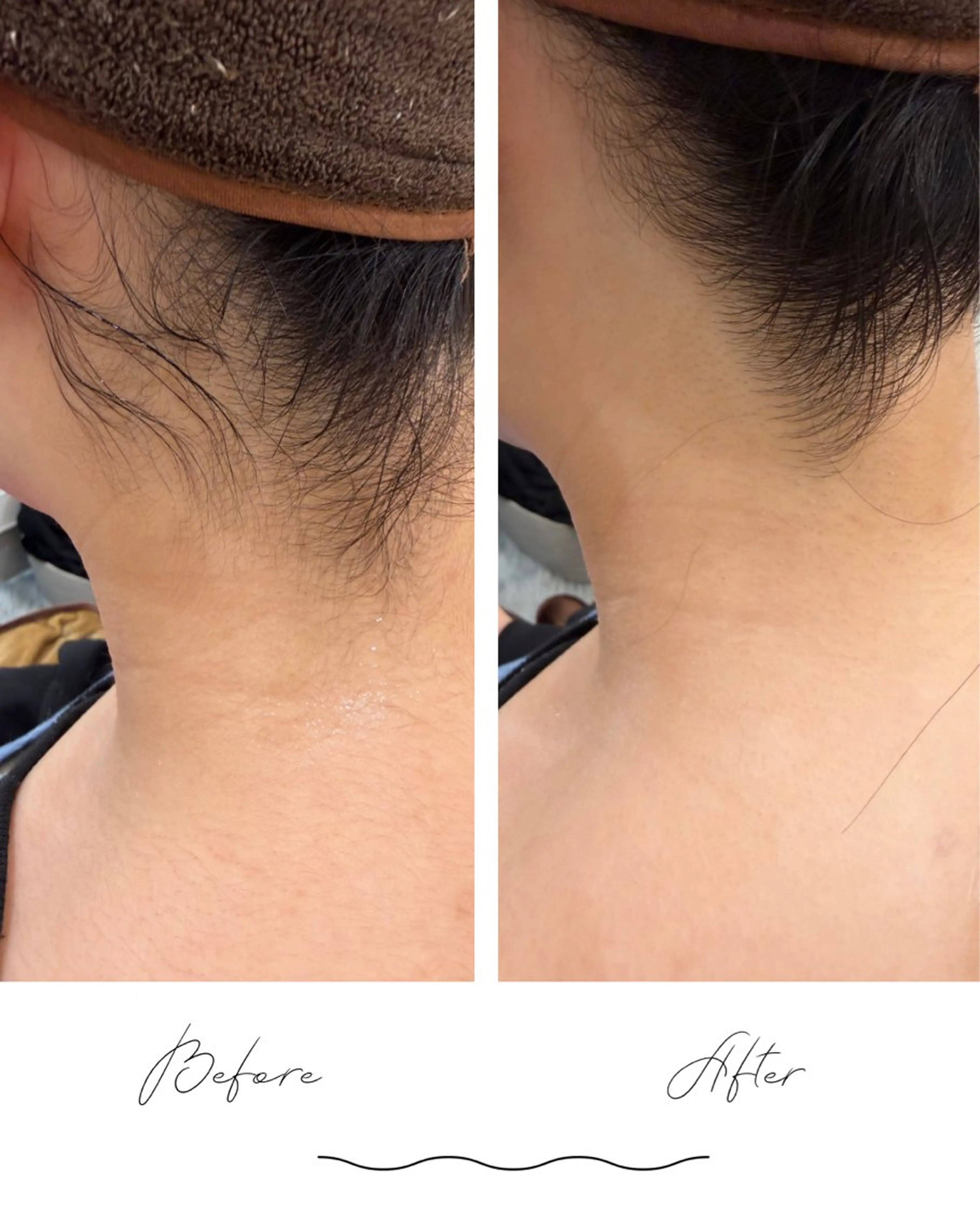 脱毛 シェイヴィスト 研修のエステ・リラクイメージ