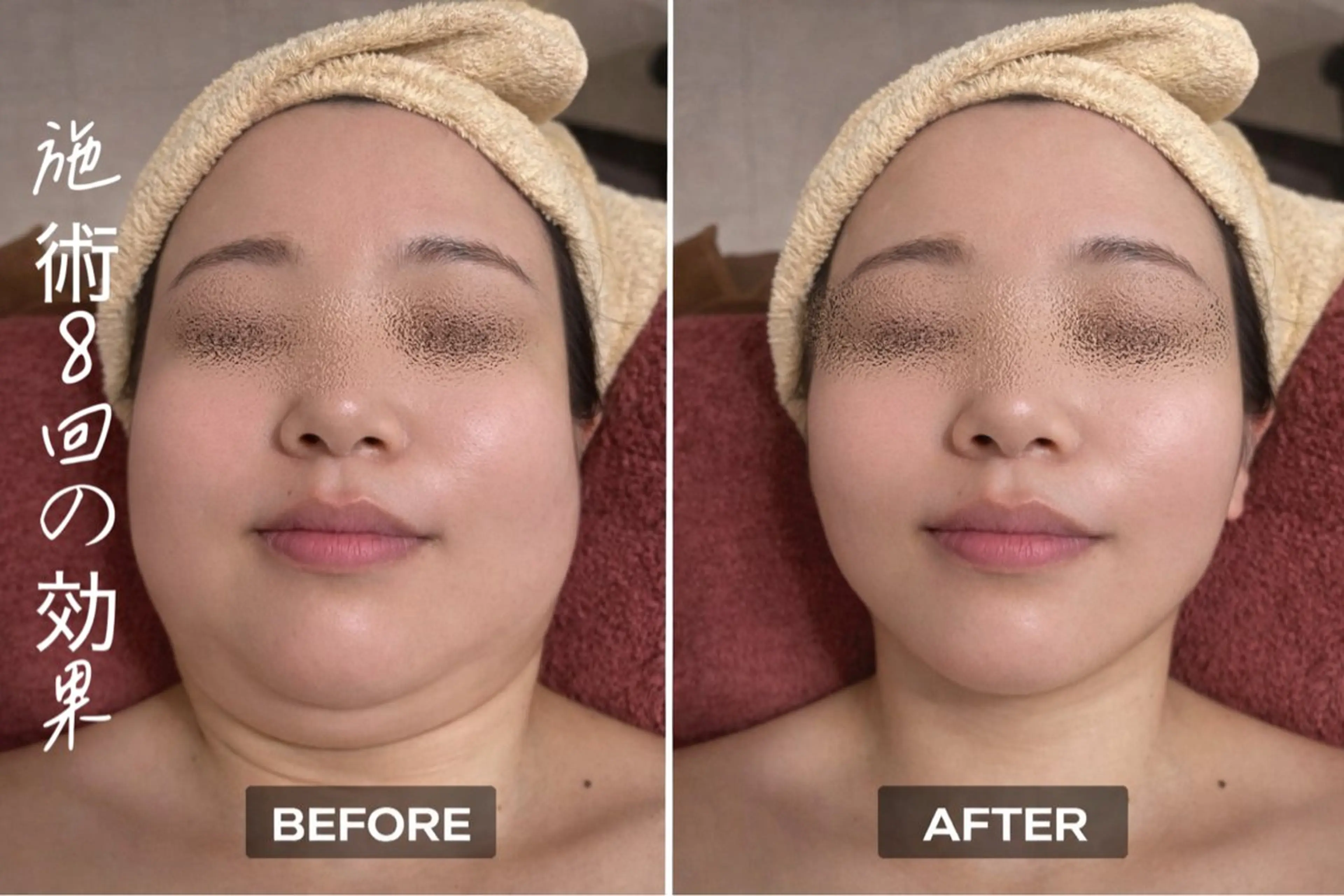 【歴13年】劇的小顔 D rマジックタッチのエステ・リラクイメージ