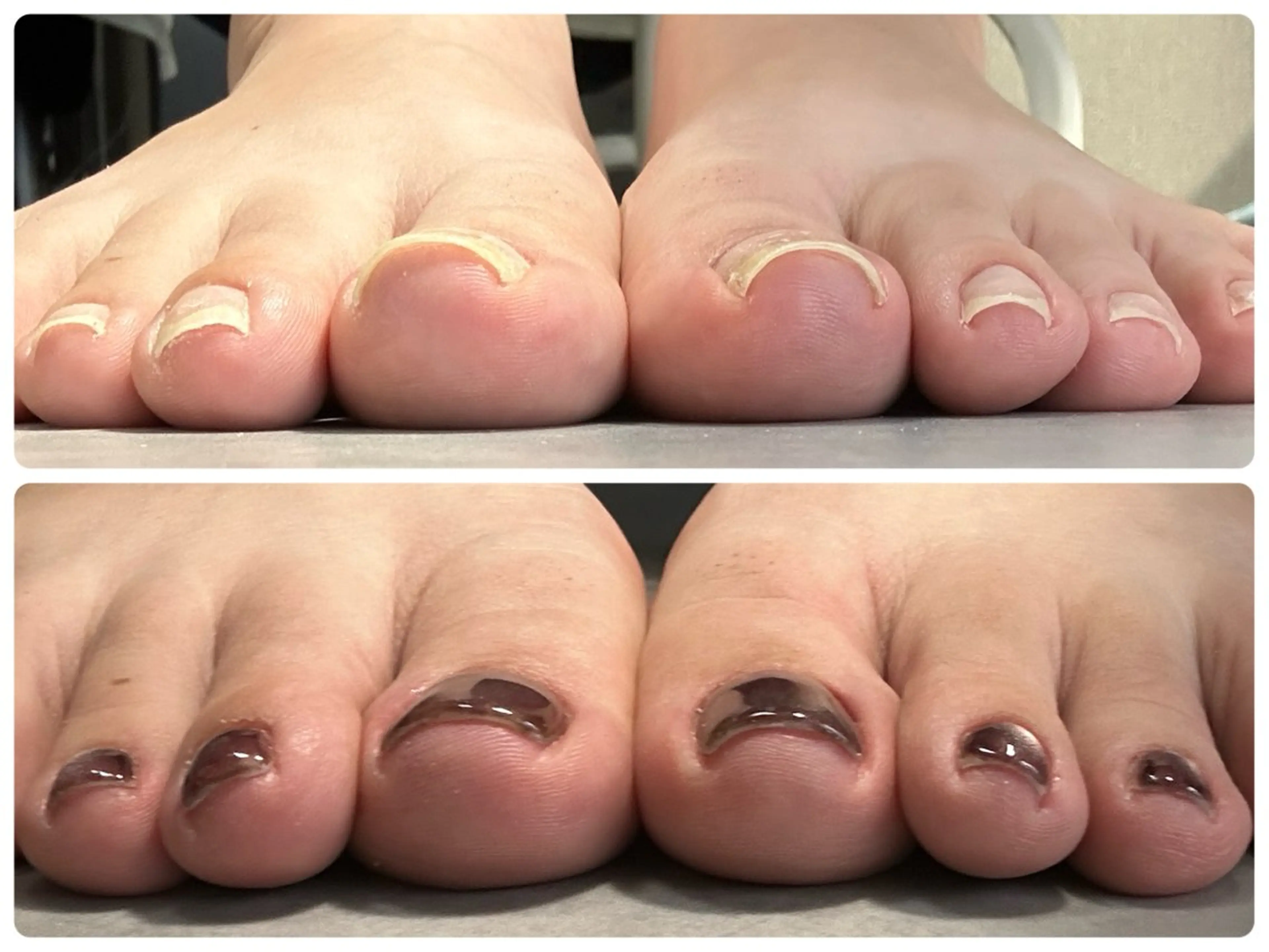 ネイル nail myuu 【ネイルミュー】のネイルデザイン