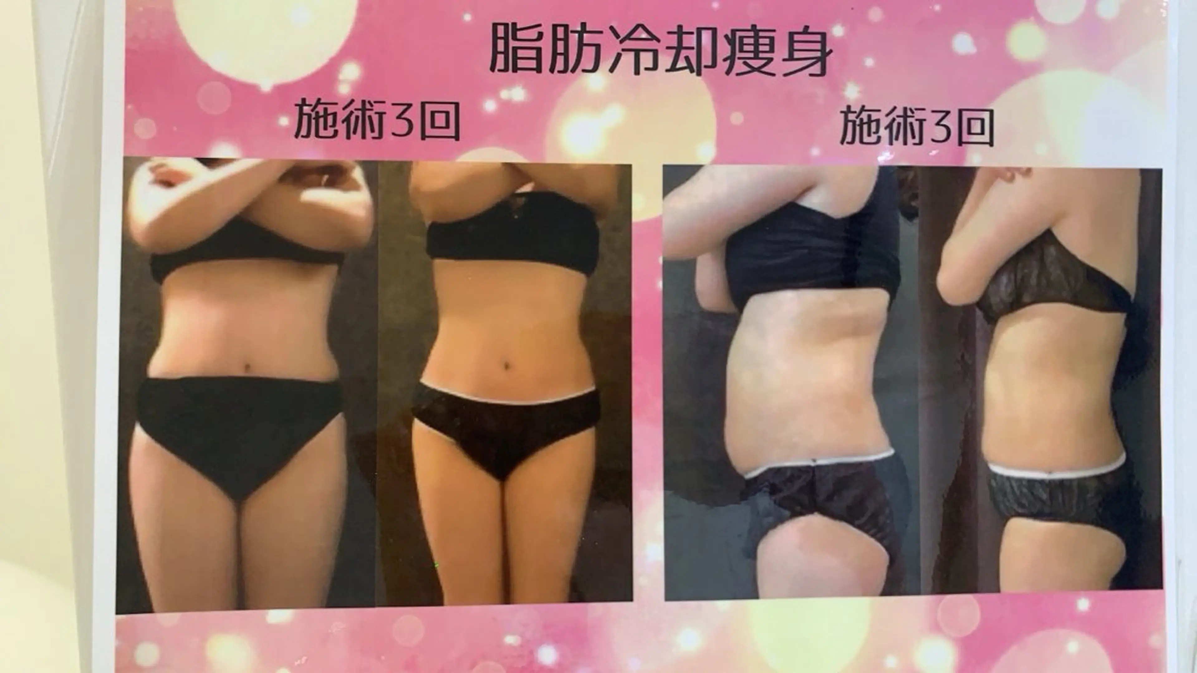 マツエク・マツパ エステ リラク 愛維美水光美肌専門店 メンズレディースokのエステ・リラクイメージ