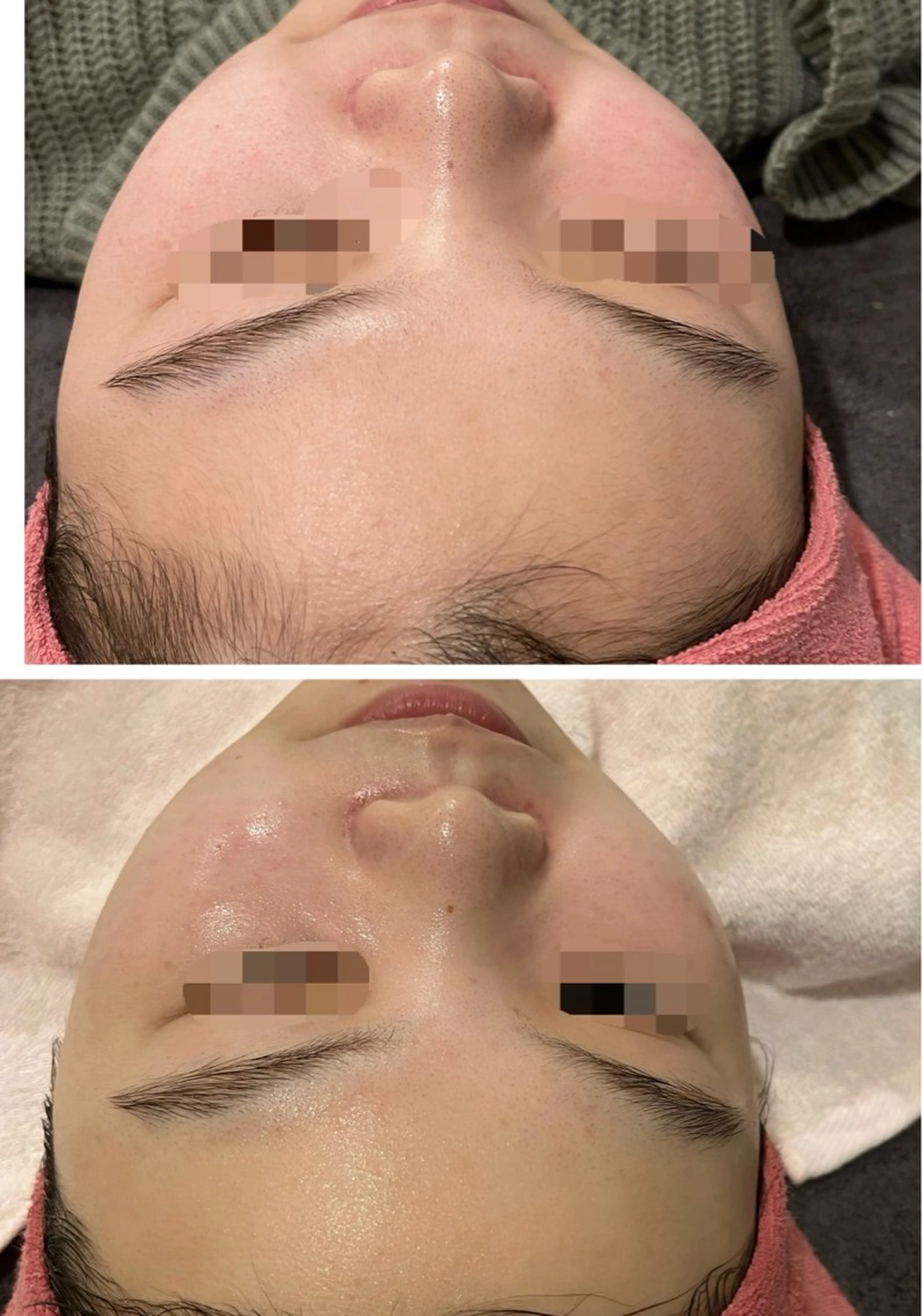 脱毛 Dione 立川店のエステ・リラクイメージ