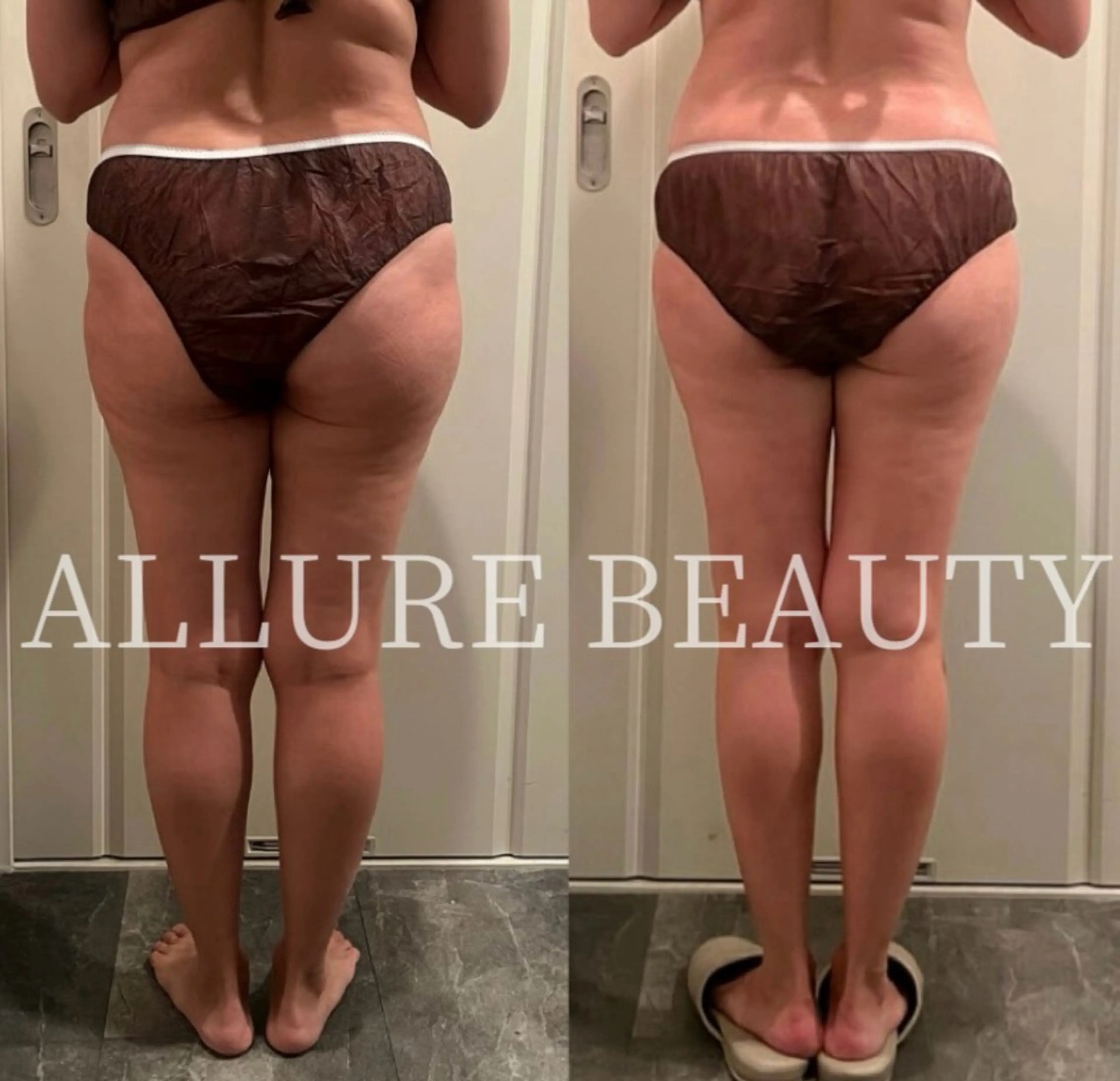 痩身/リラク 🎀KOZUKAのエステ・リラクイメージ