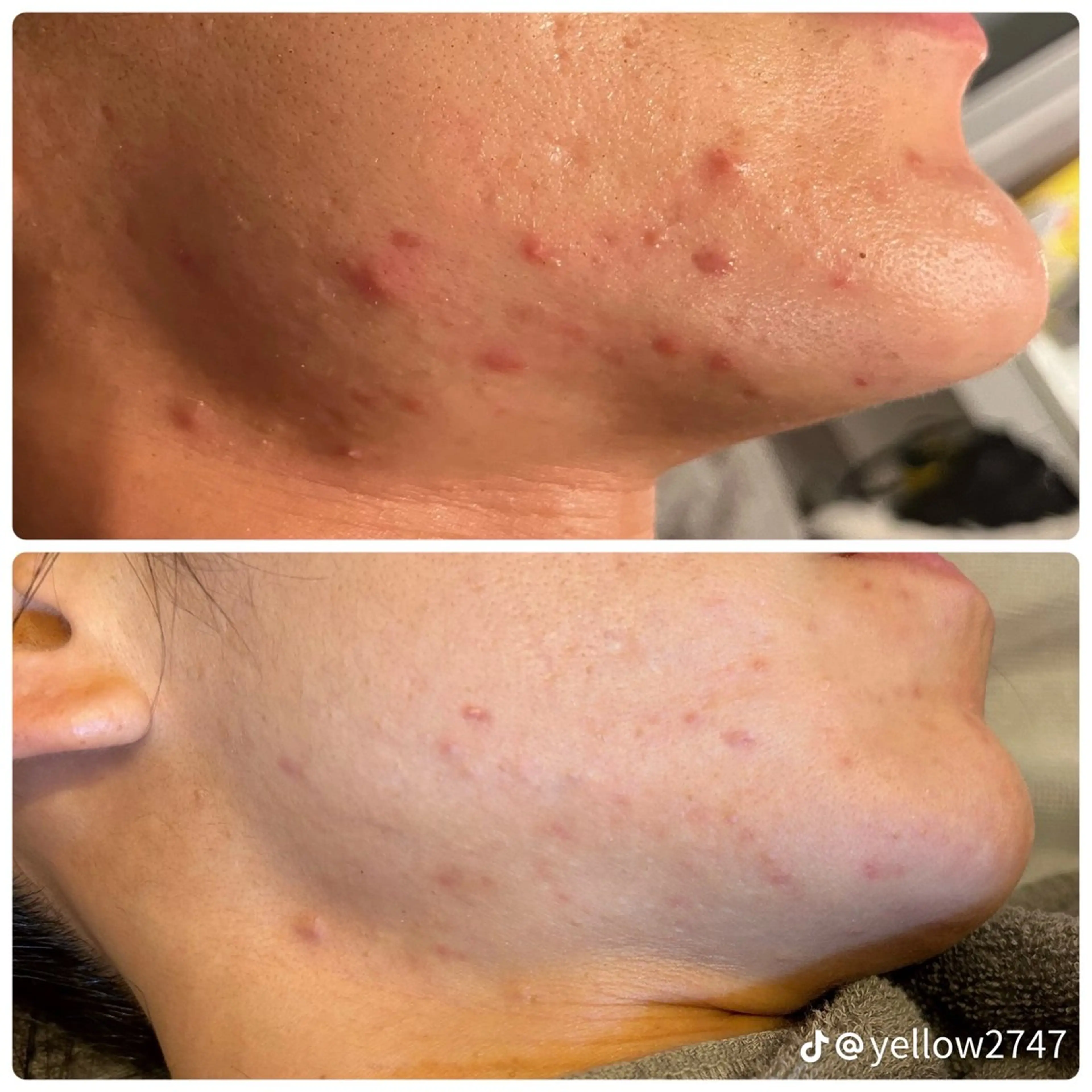 メンズ blue.💙【 脱毛&フェイシャル】のエステ・リラクイメージ