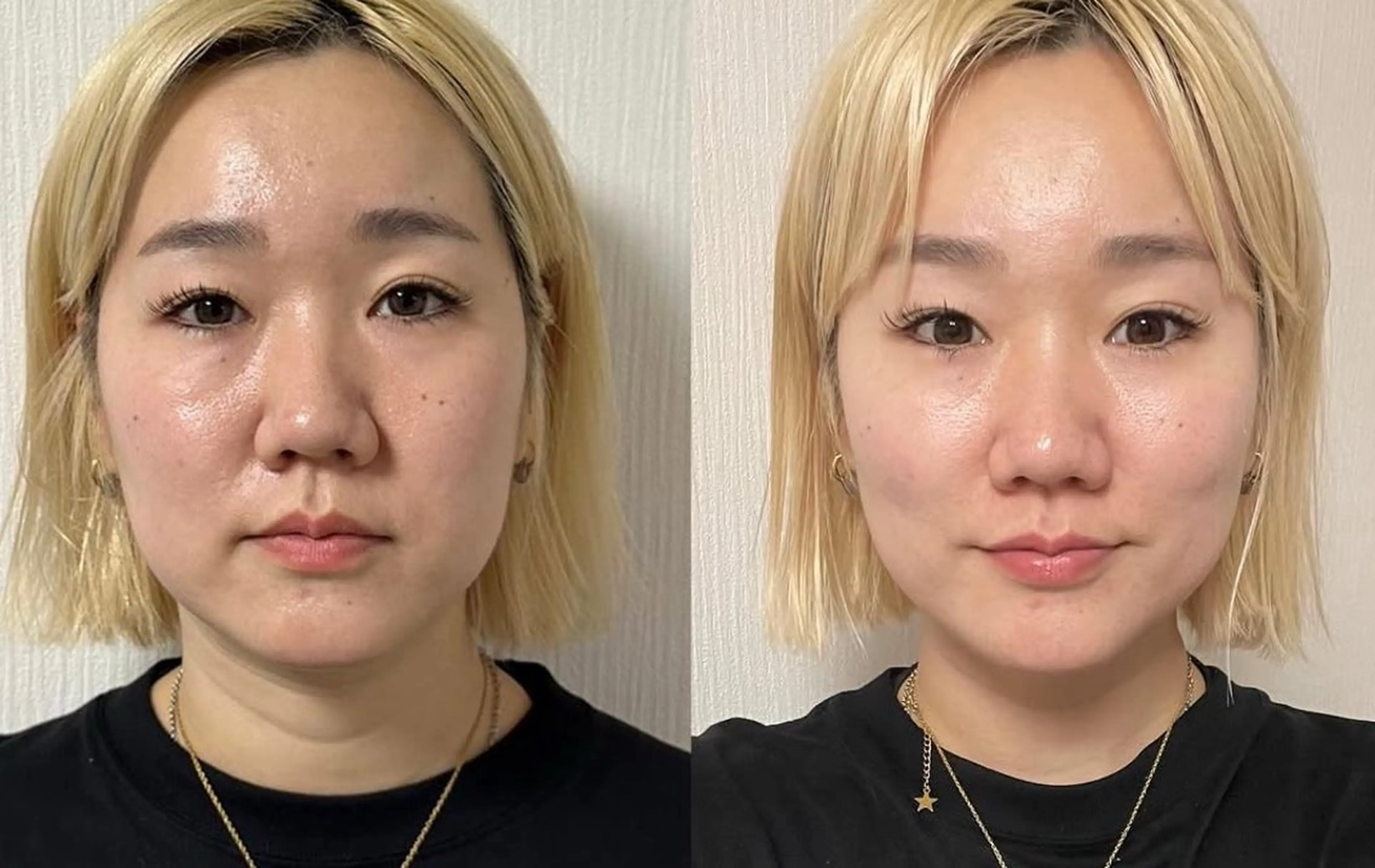 エステ リラク 耳ツボ/体質改善/ 温活La mer月島のその他イメージ