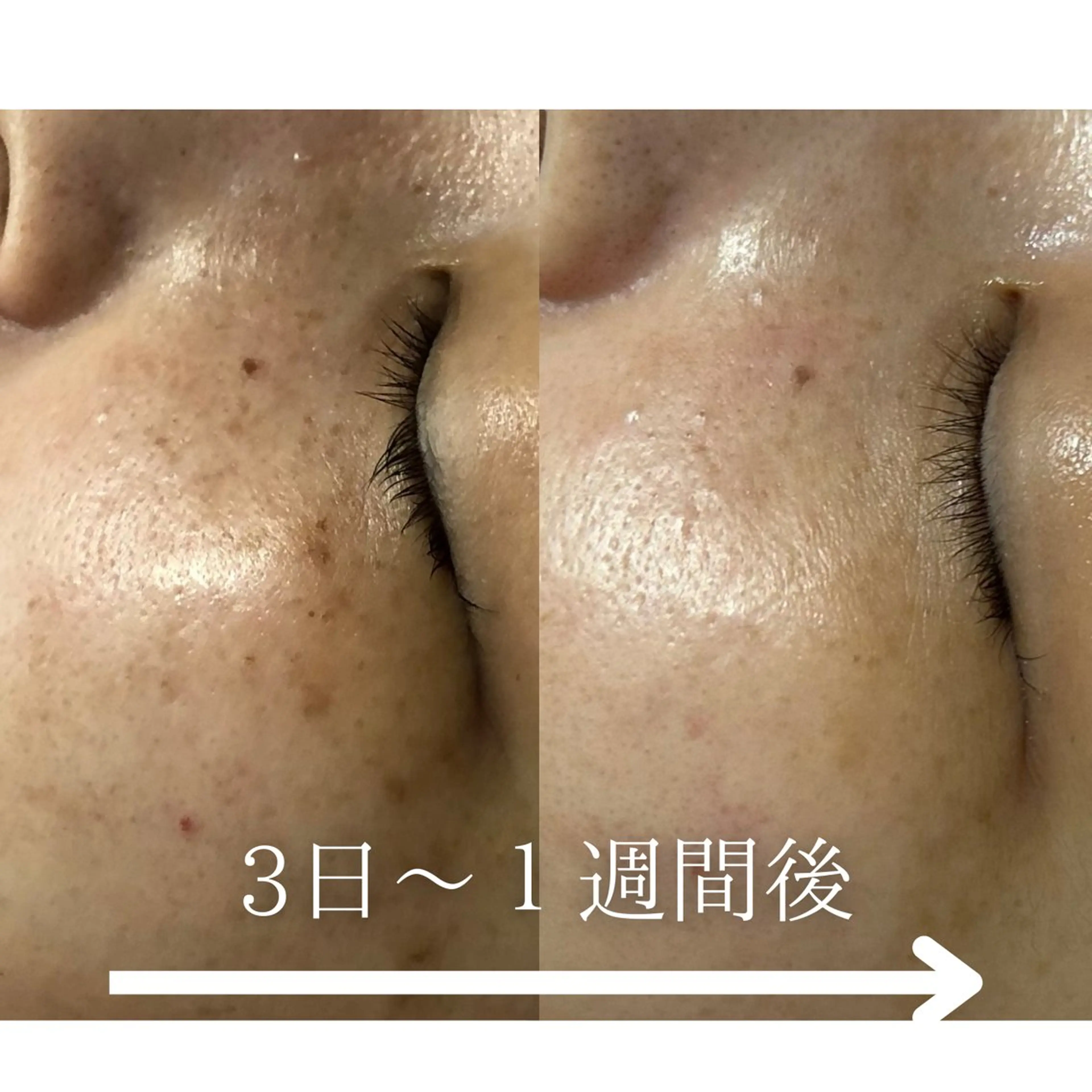 エステ BestBelleꕤ 大阪福島/肌質改善のエステ・リラクイメージ