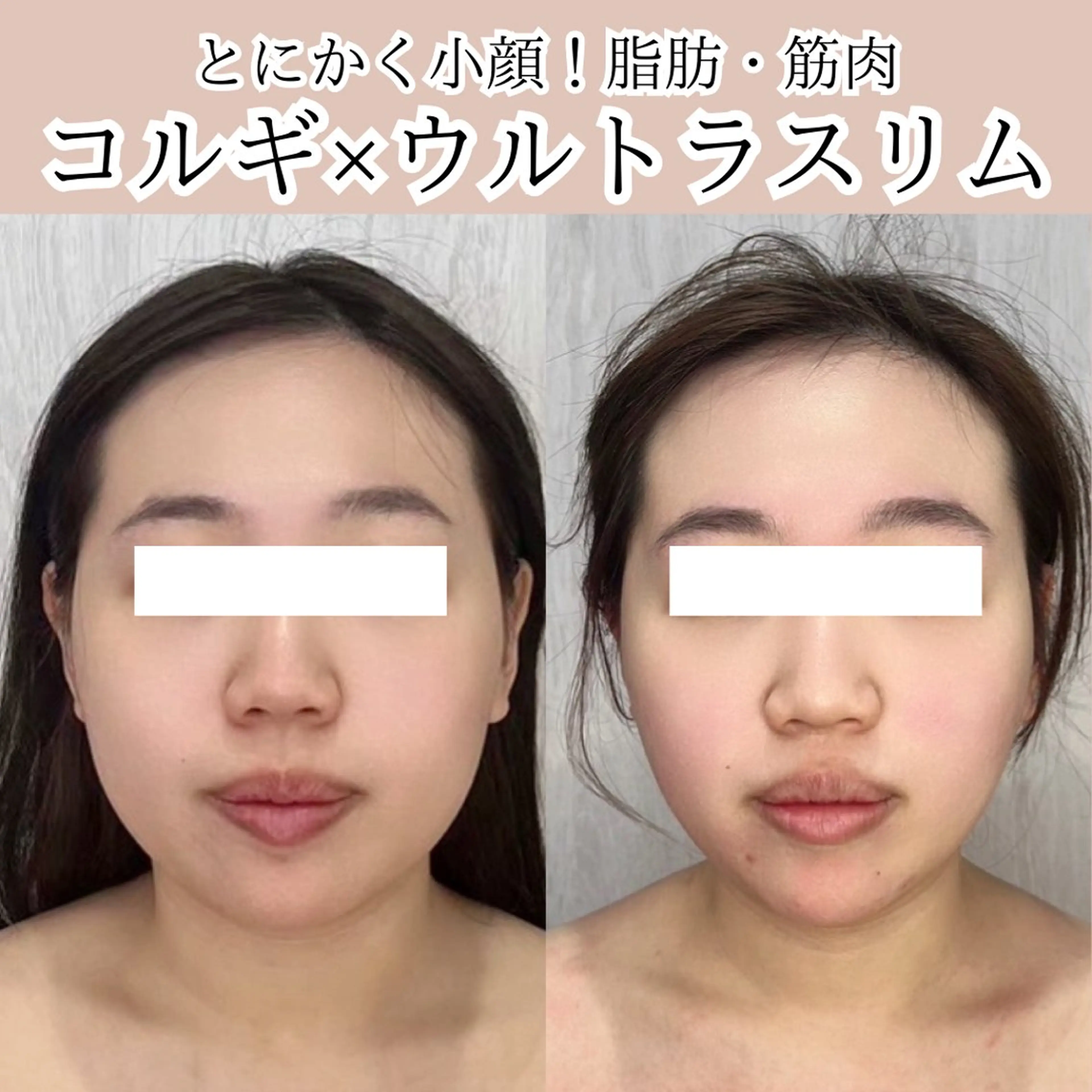 第一印象専門サロン ADISEのエステ・リラクイメージ