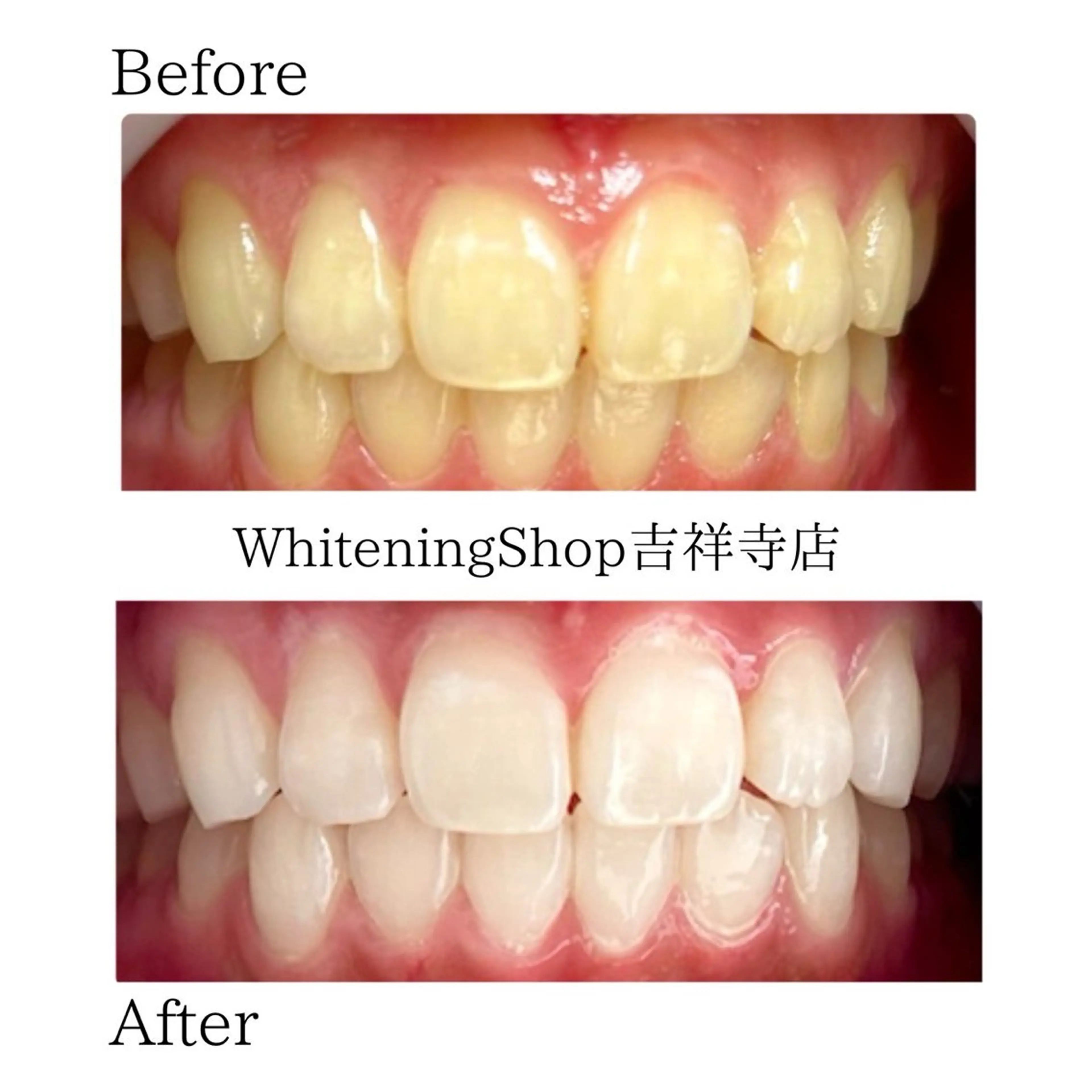 エステ リラク ホワイトニング ショップ吉祥寺店のエステ・リラクイメージ