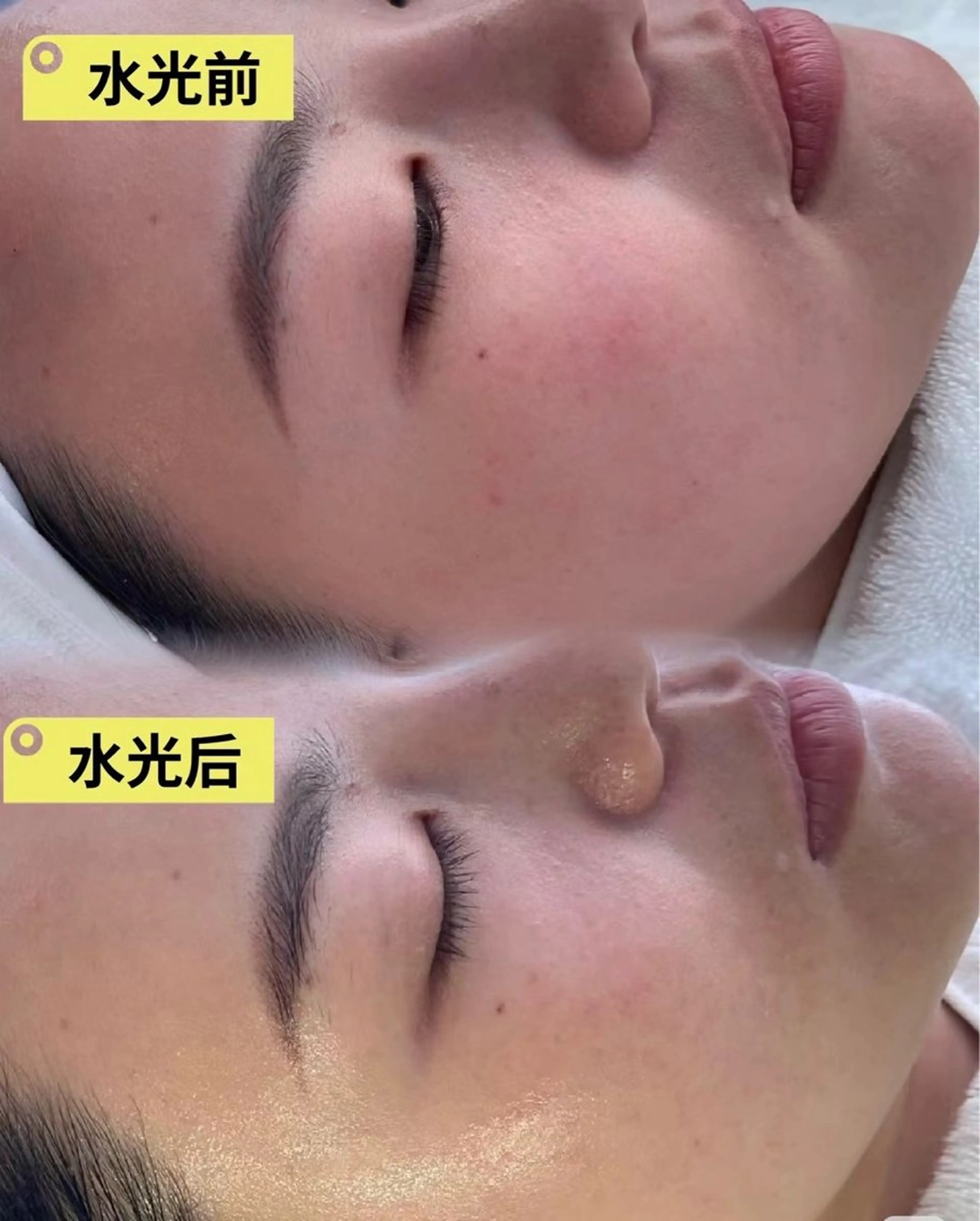 マツエク・マツパ エステ リラク 愛維美水光美肌専門店所属・愛維美水光美肌専門店 メンズレディースokのエステ・リラクイメージ