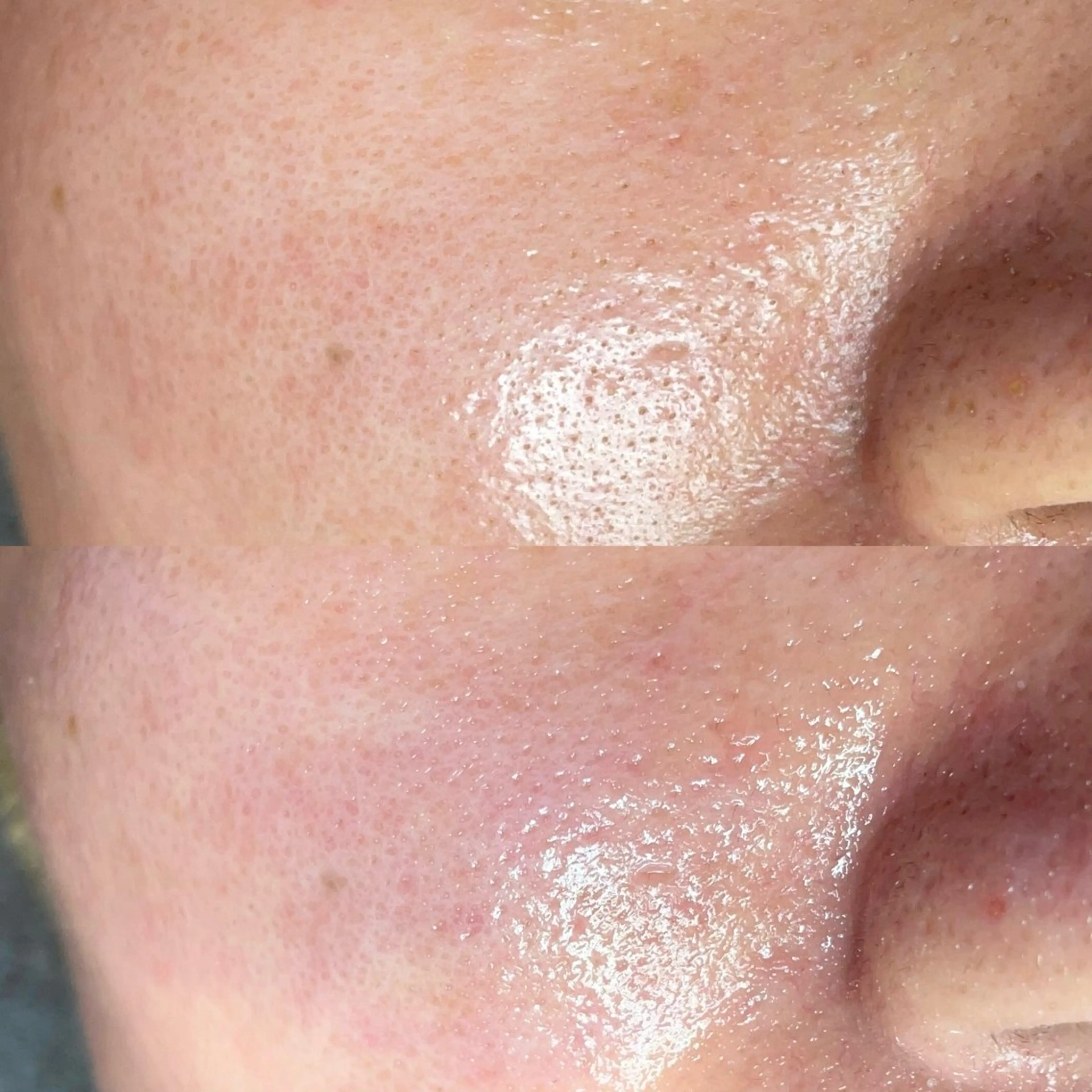 毛穴専門店MeMe.八千代店所属・毛穴・頭皮 専門店💪のその他イメージ