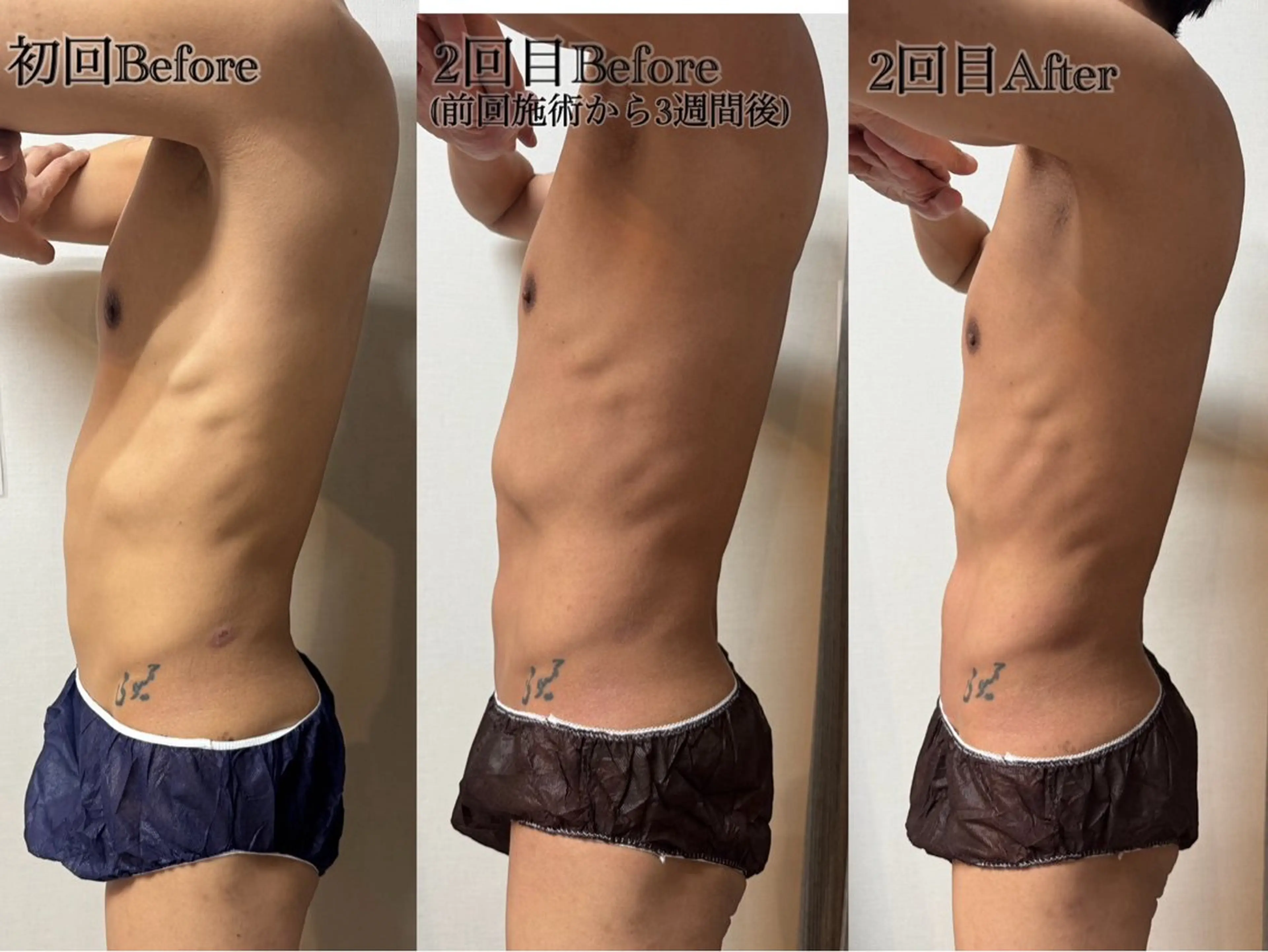 六本木脱毛andS さおりのエステ・リラクイメージ