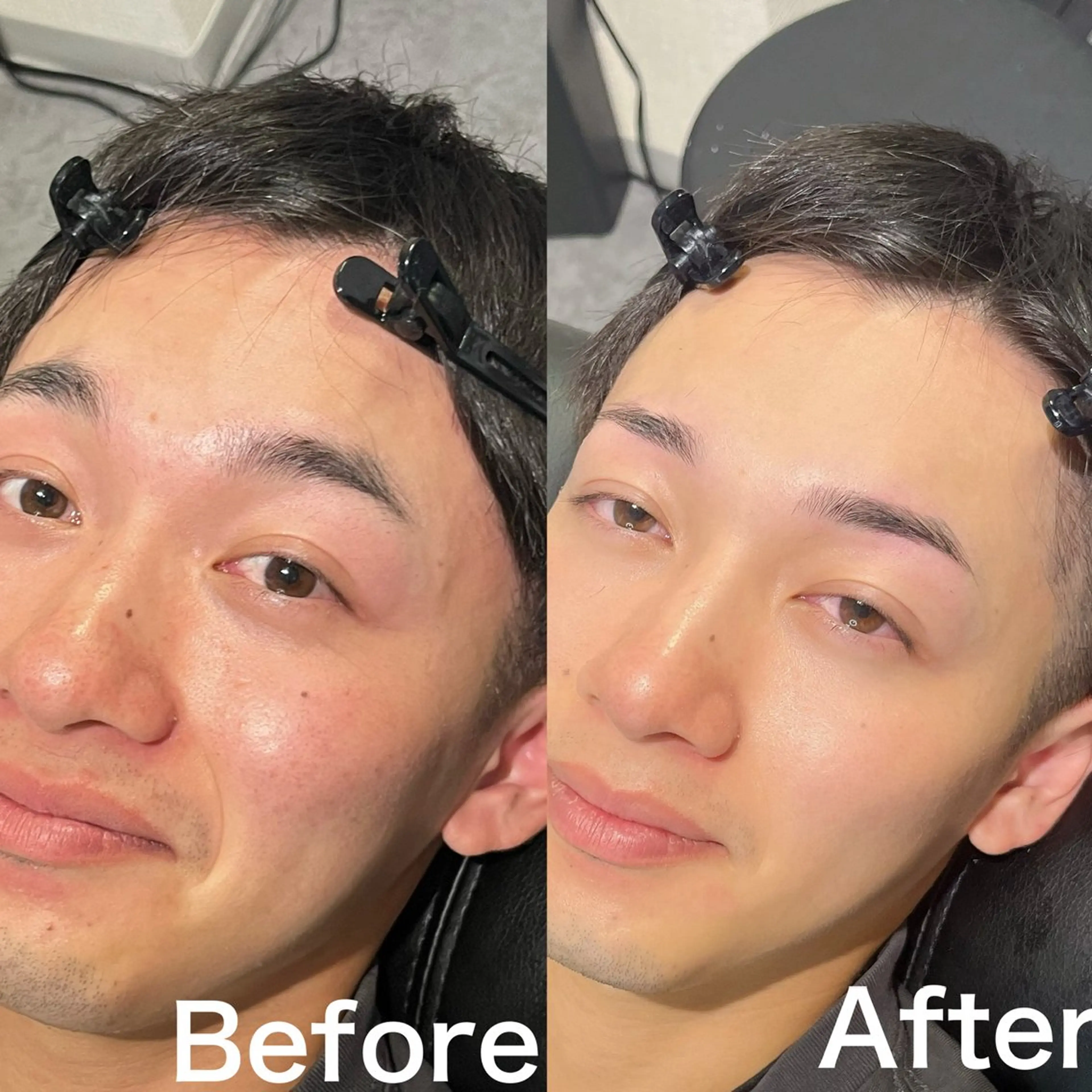 アイブロウ ワックス脱毛 眉カット その他(アイブロウ) 5日◯ Yusukeの眉毛・アイブロウイメージ