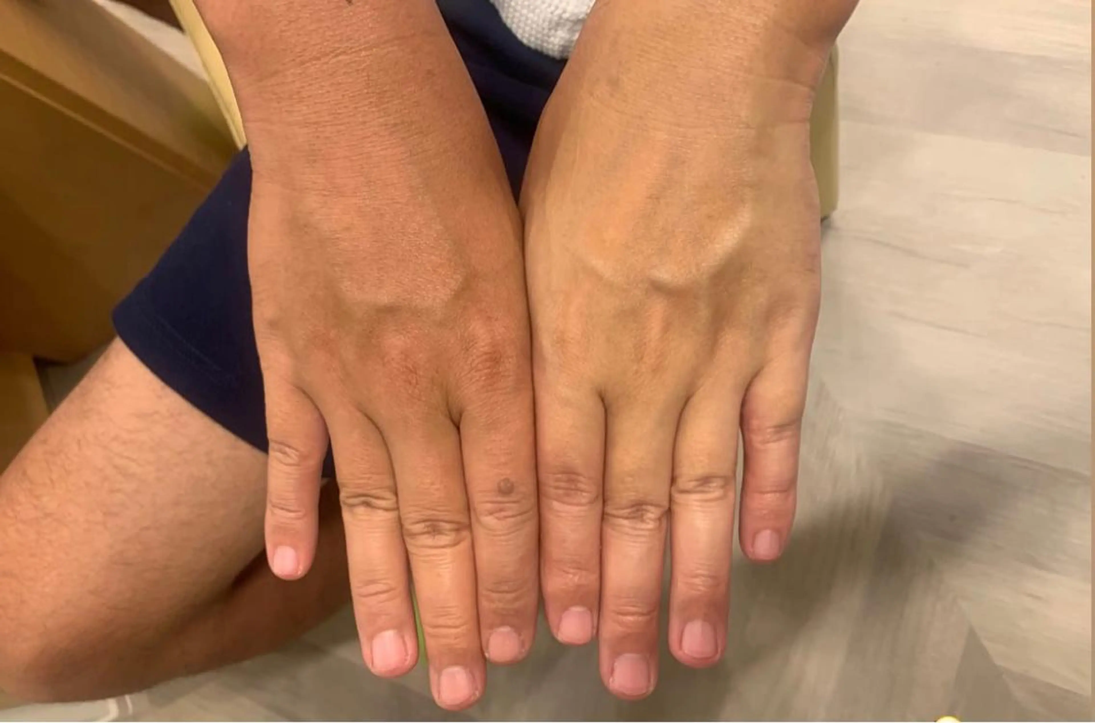 フェイシャルエステ 🌼肌改善🫧のエステ・リラクイメージ