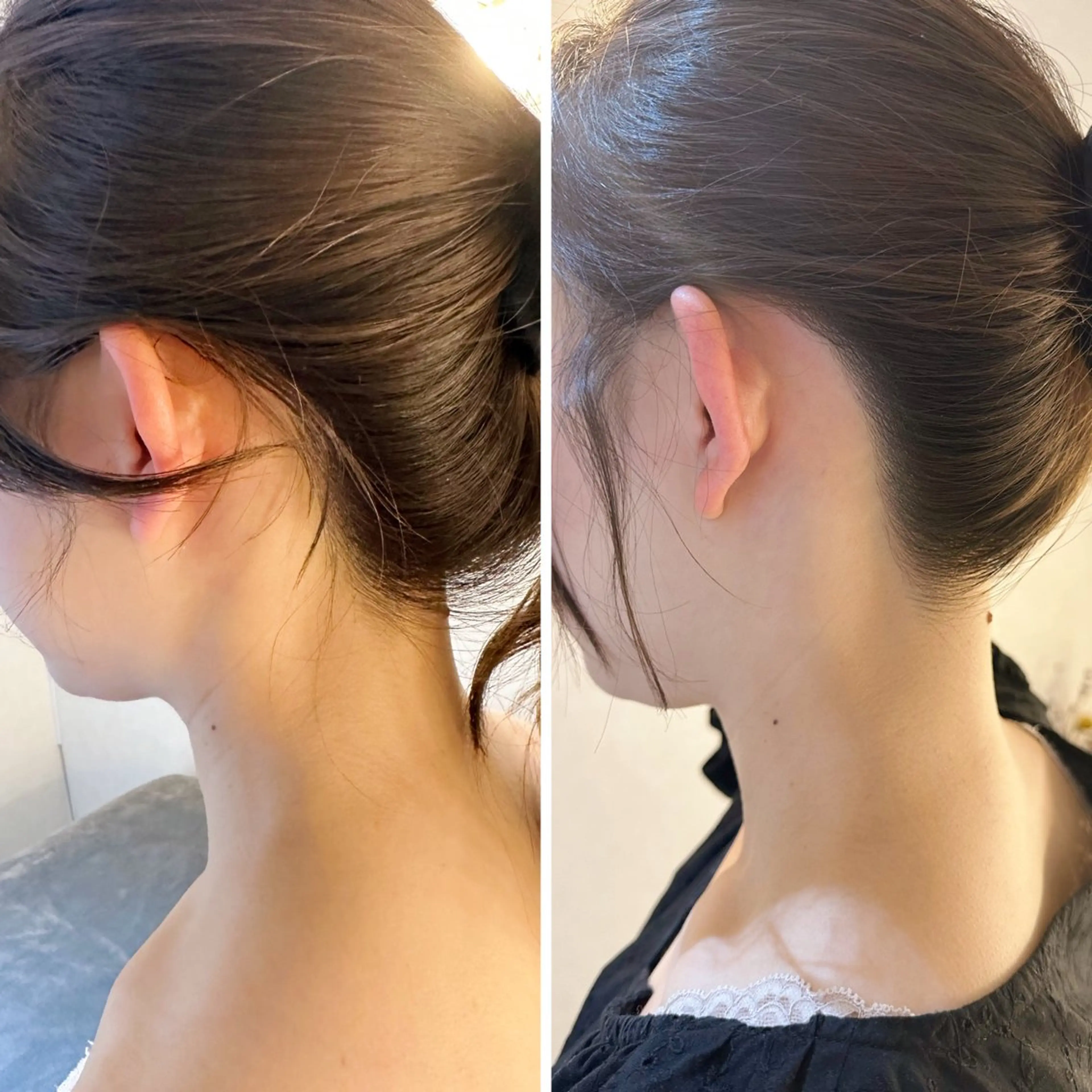 脱毛 うなじ脱毛/美肌脱毛 LABELのエステ・リラクイメージ