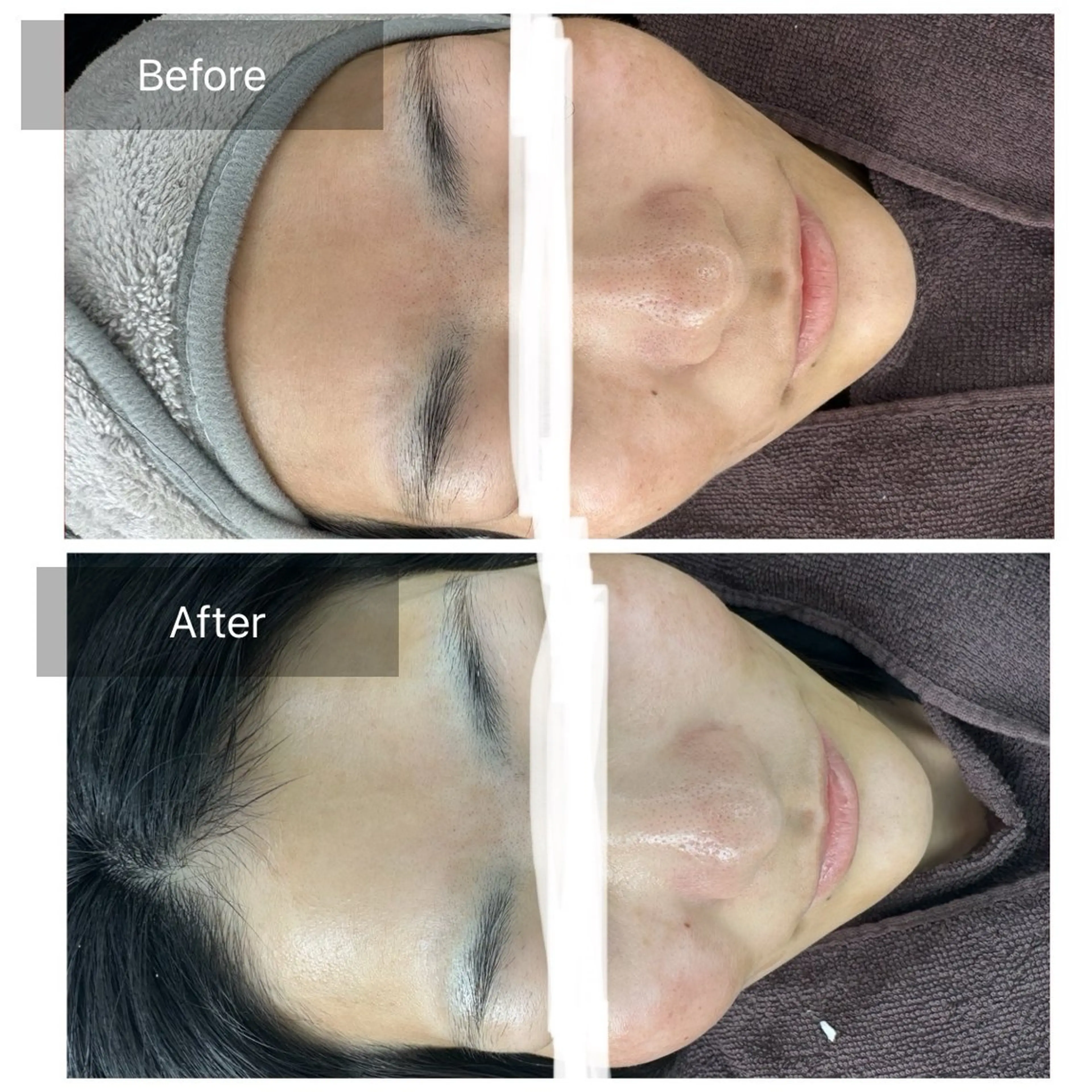 脱毛 トータルしみケア専門 NICA(ニカ)の眉毛・アイブロウイメージ