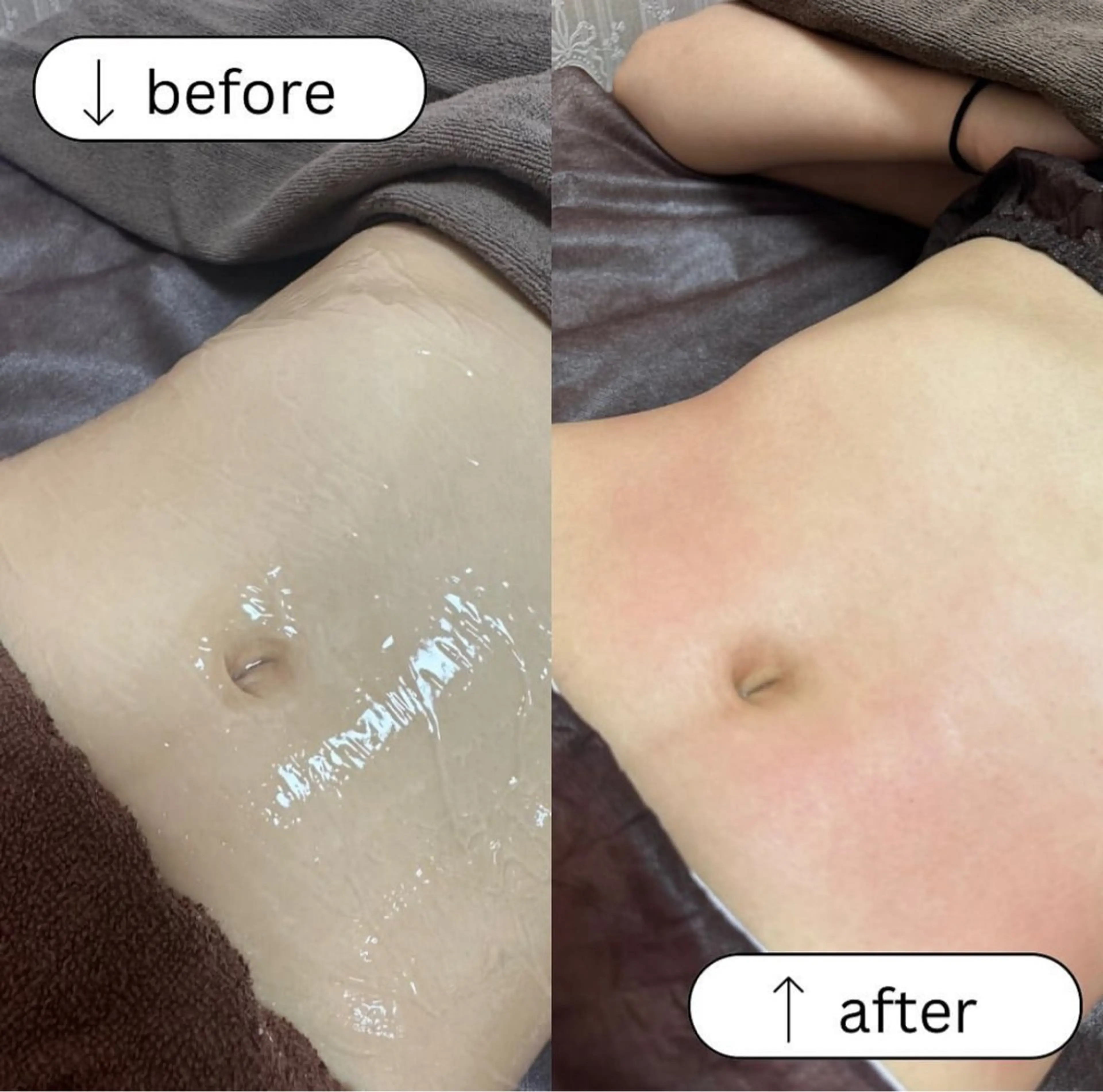 エステ Brilliet所属・ブリリエット 橋田のその他イメージ