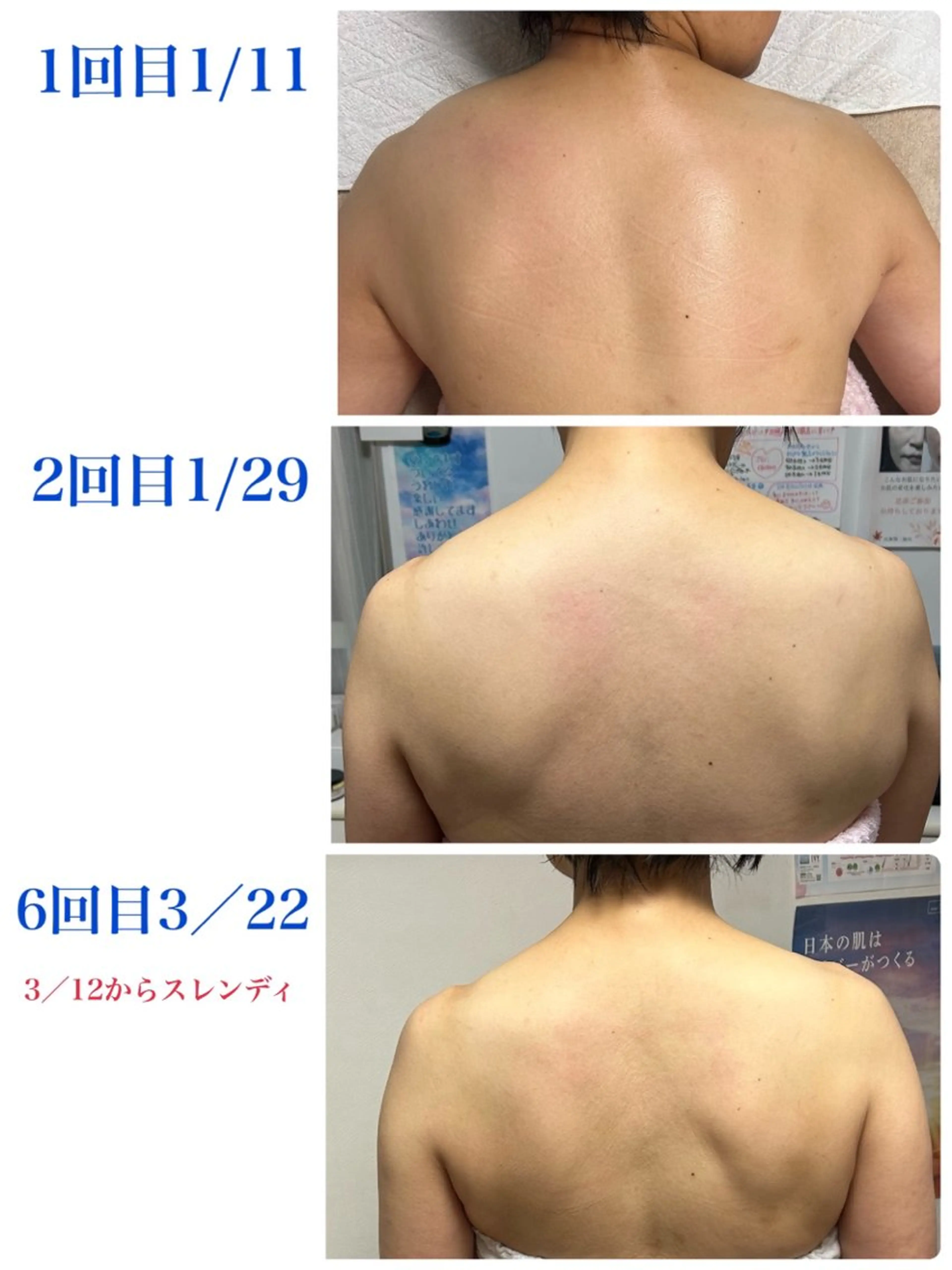 エステ リラク 肌の質を変えるエステ 🤍🫧Nanaのエステ・リラクイメージ