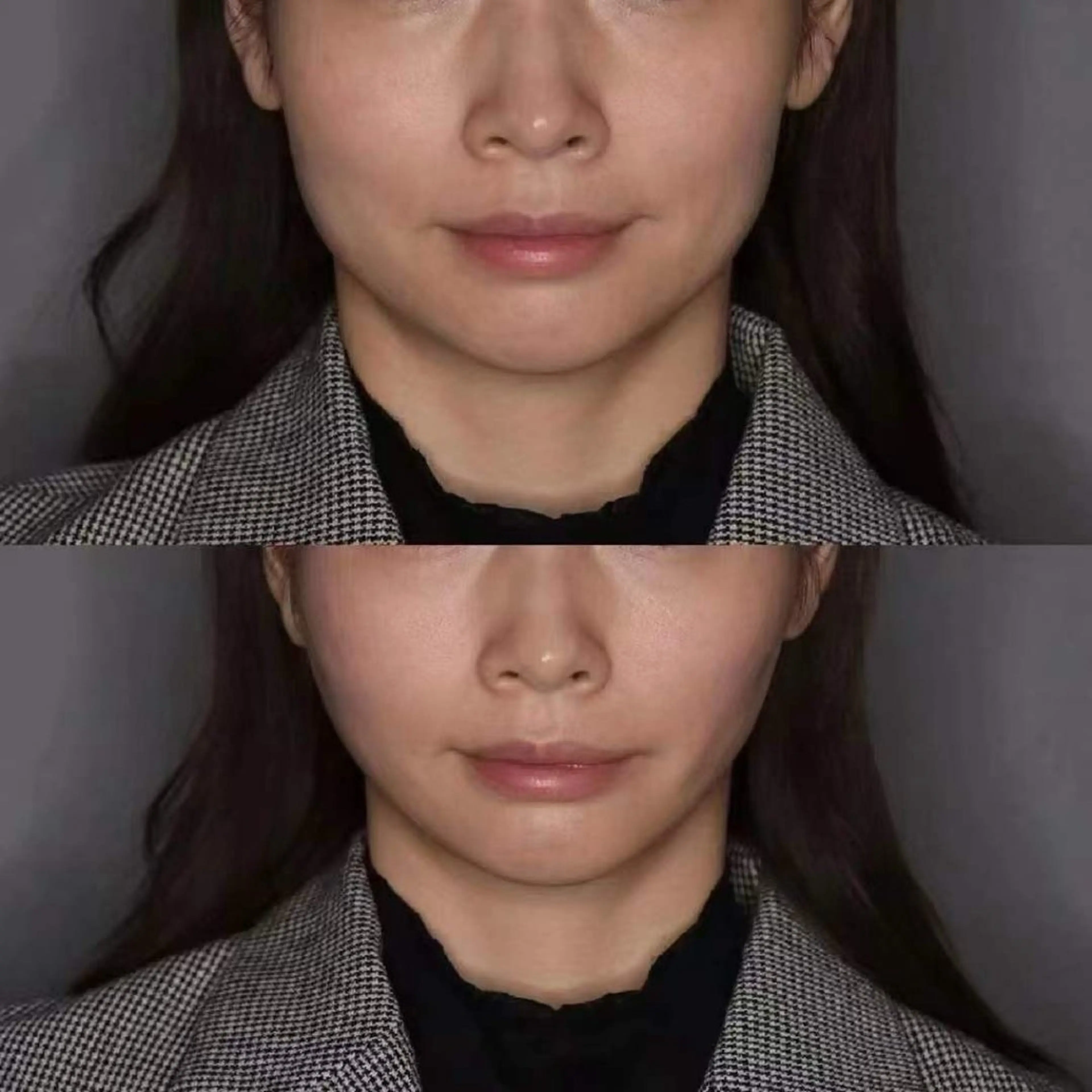 マツエク・マツパ エステ aliaハイフ&水光ジェットサロン所属・aliaハーブ水光店 エステティシャン募集のエステ・リラクイメージ