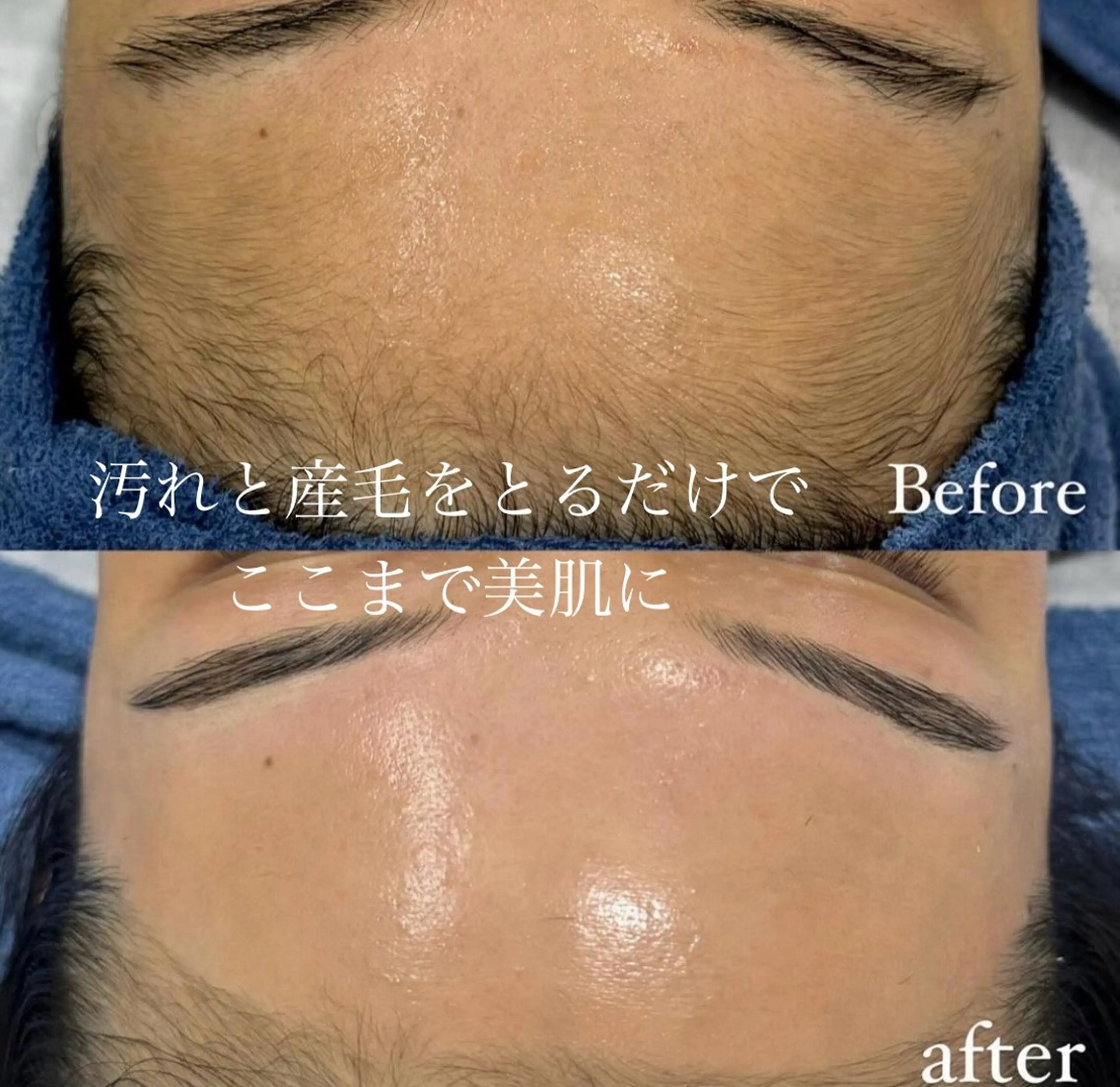 CHIO🌷心斎橋 毛穴・艶肌専門店のエステ・リラクイメージ