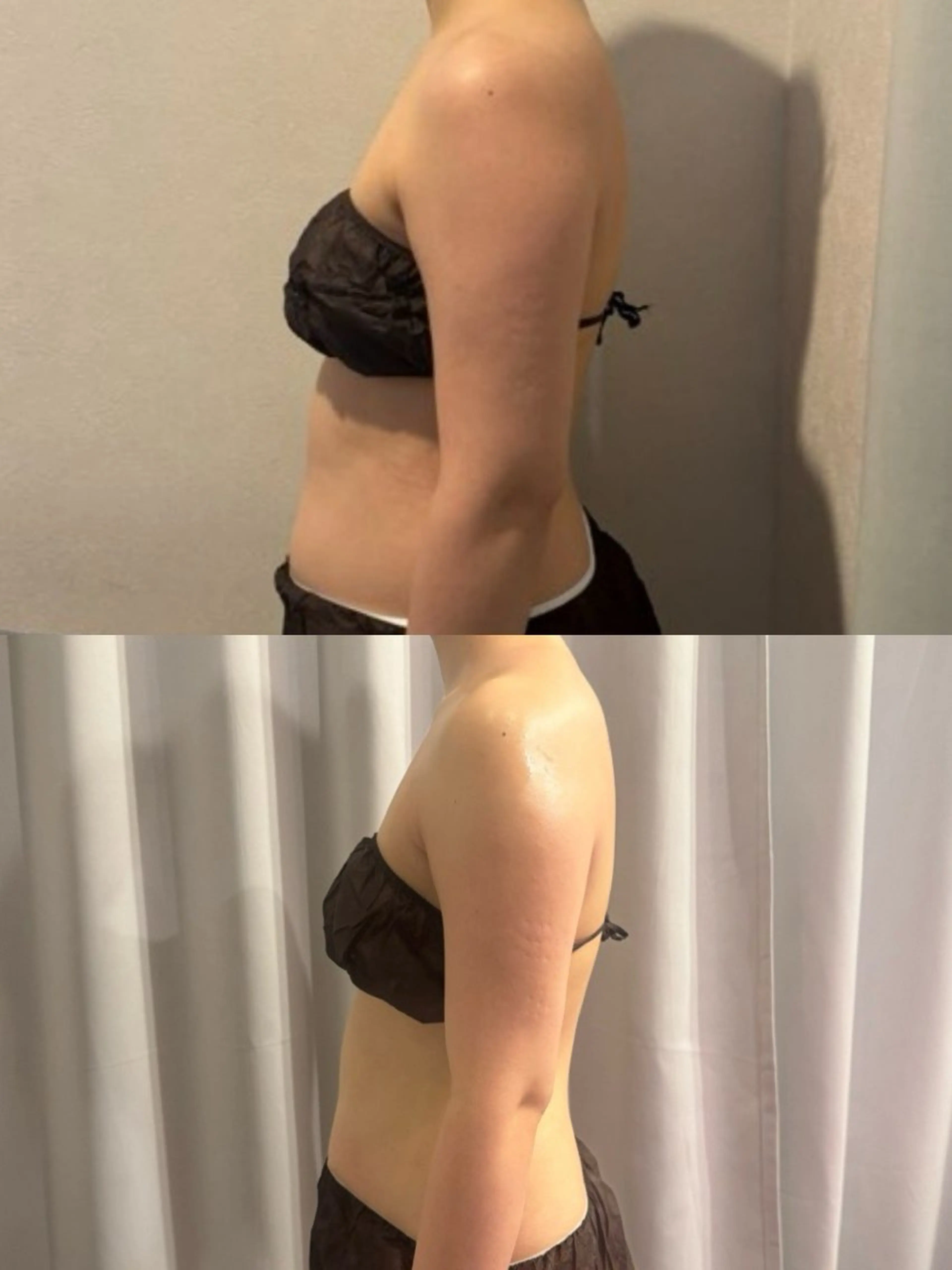 エステ 小顔矯正|痩身 miélusalonのエステ・リラクイメージ