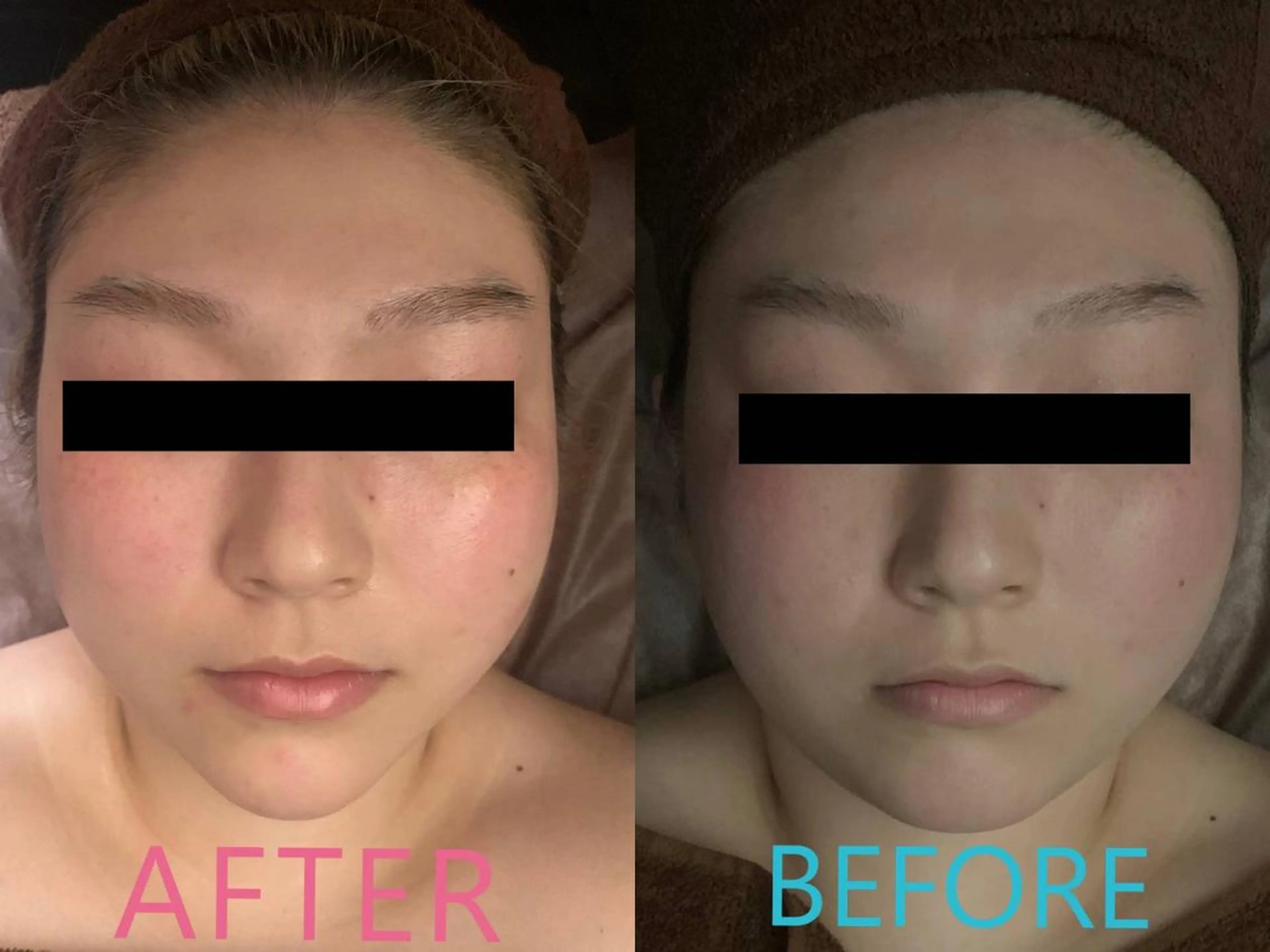 うえば すみかのエステ・リラクイメージ