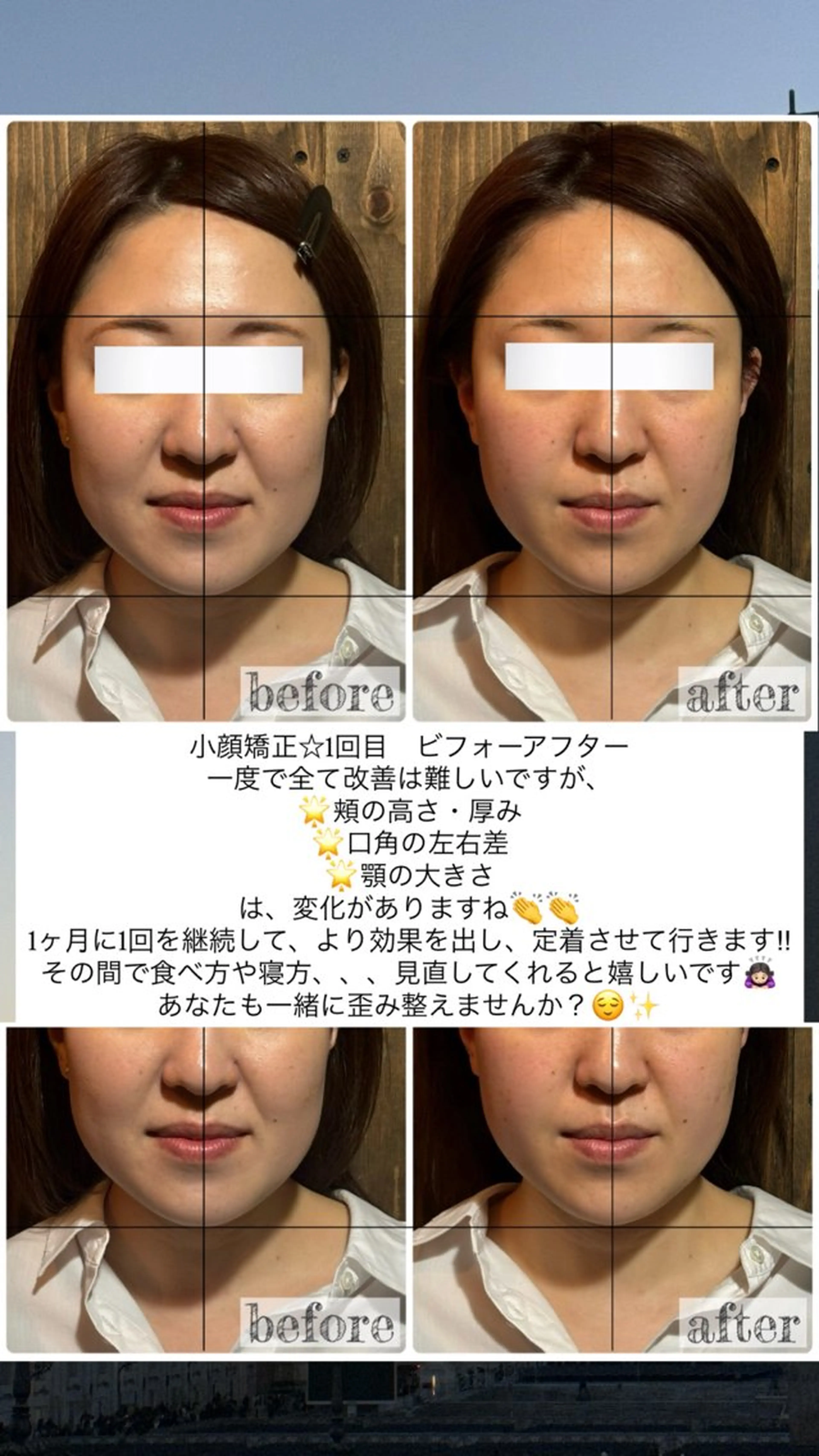 エステ リラク 💎後悔させない小顔 矯正💎イトヤマ🌱のエステ・リラクイメージ