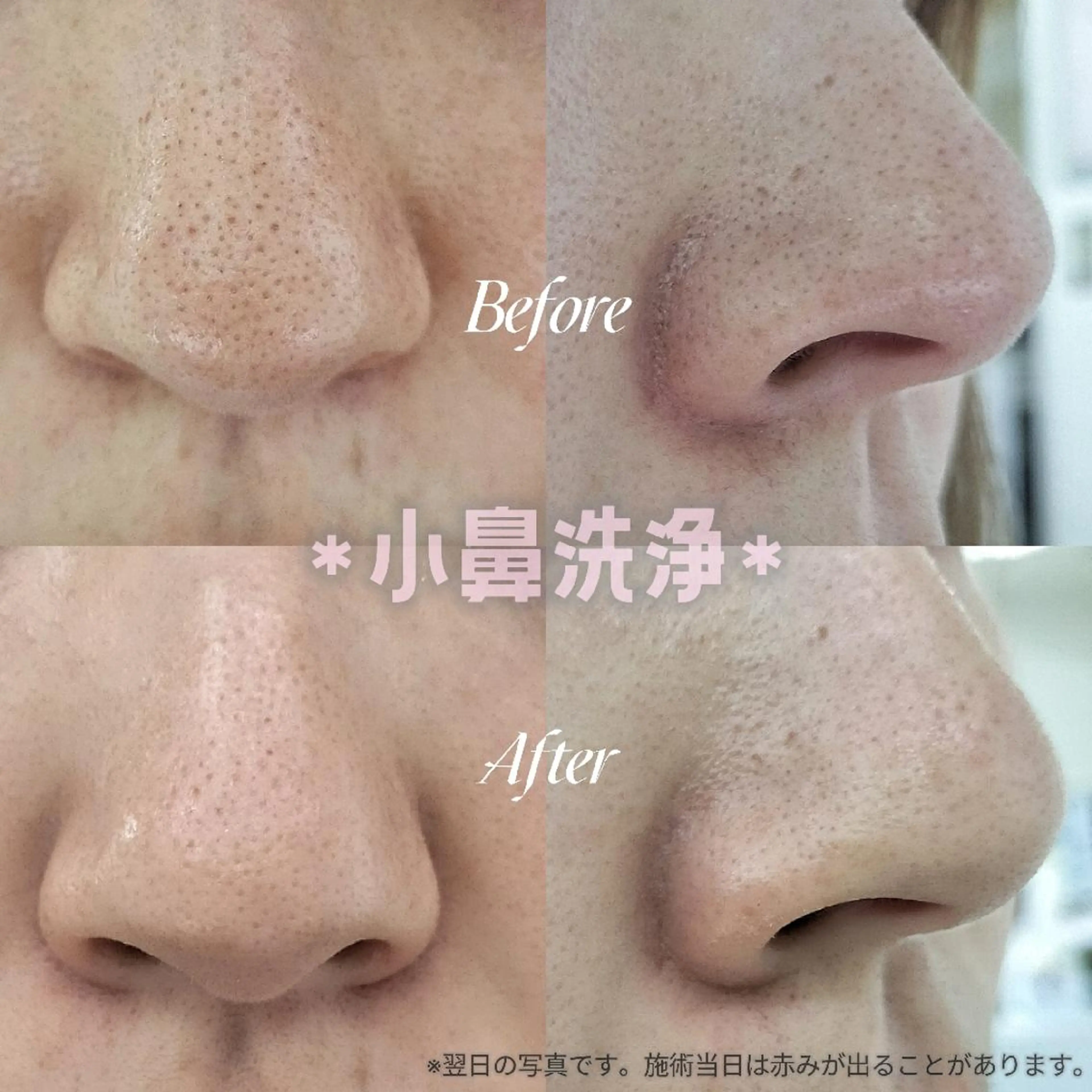 小川 アリサのマツエク・マツパデザイン