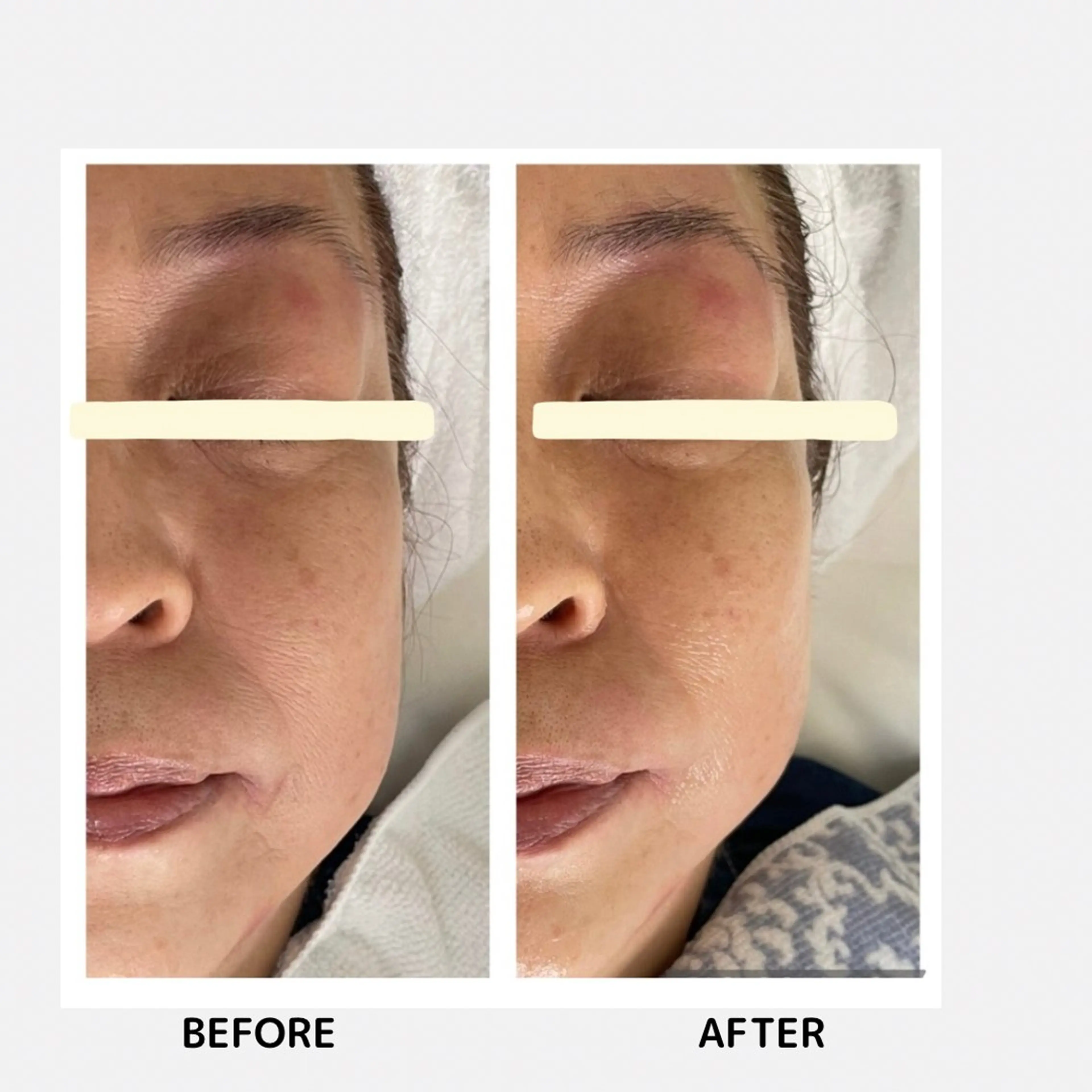 Yoshino Erinaのエステ・リラクイメージ