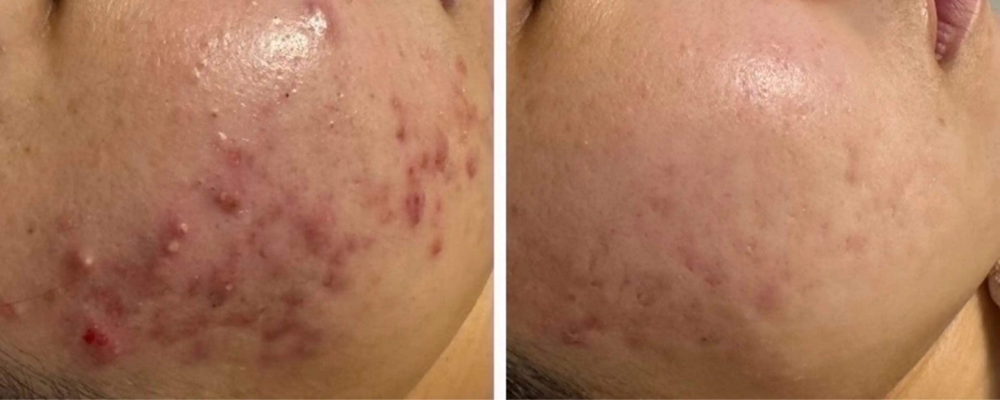 エステ ÉLAN クリニカルサロンのエステ・リラクイメージ