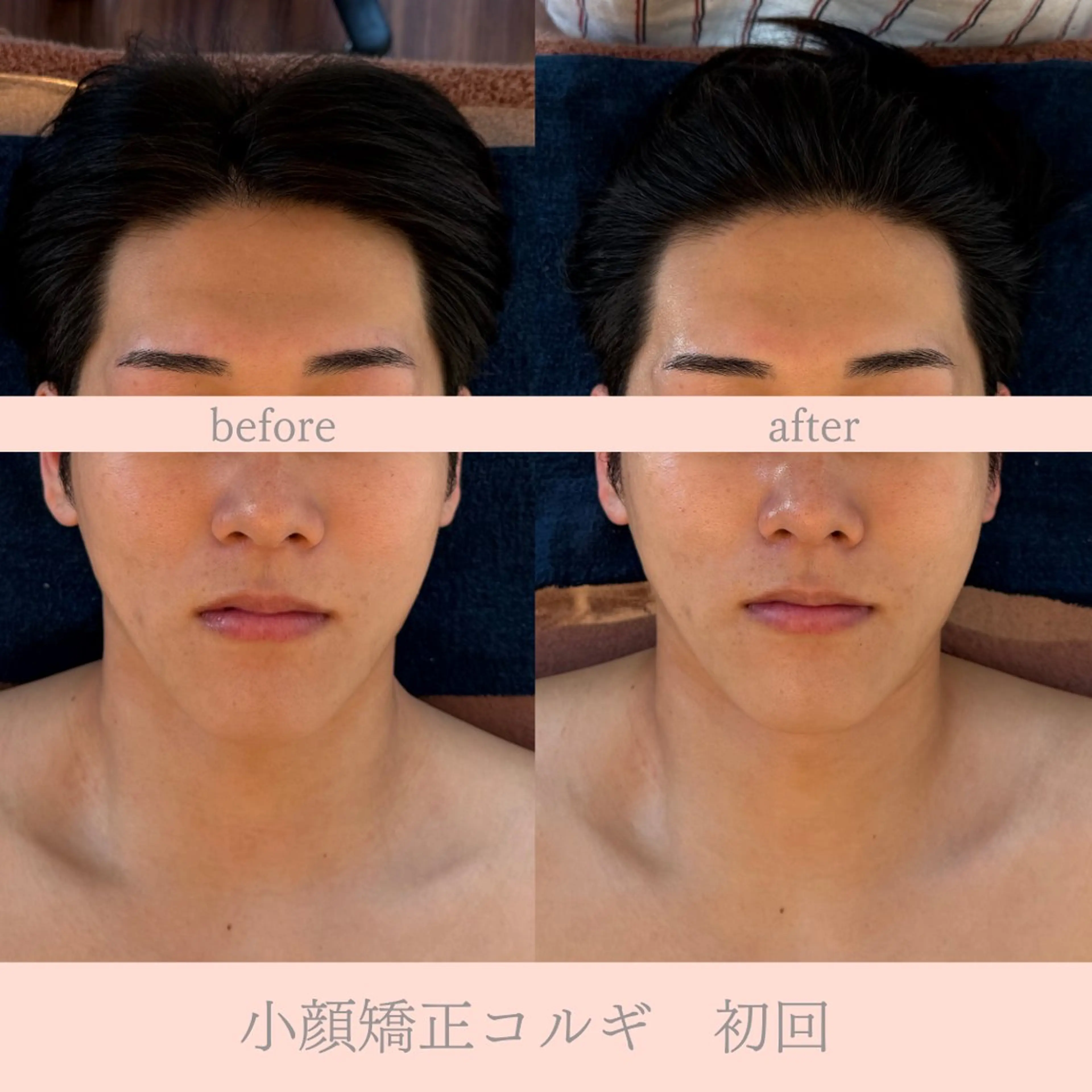 エステ 眉毛/小顔/ハーブ 🌼hikaruの眉毛・アイブロウイメージ