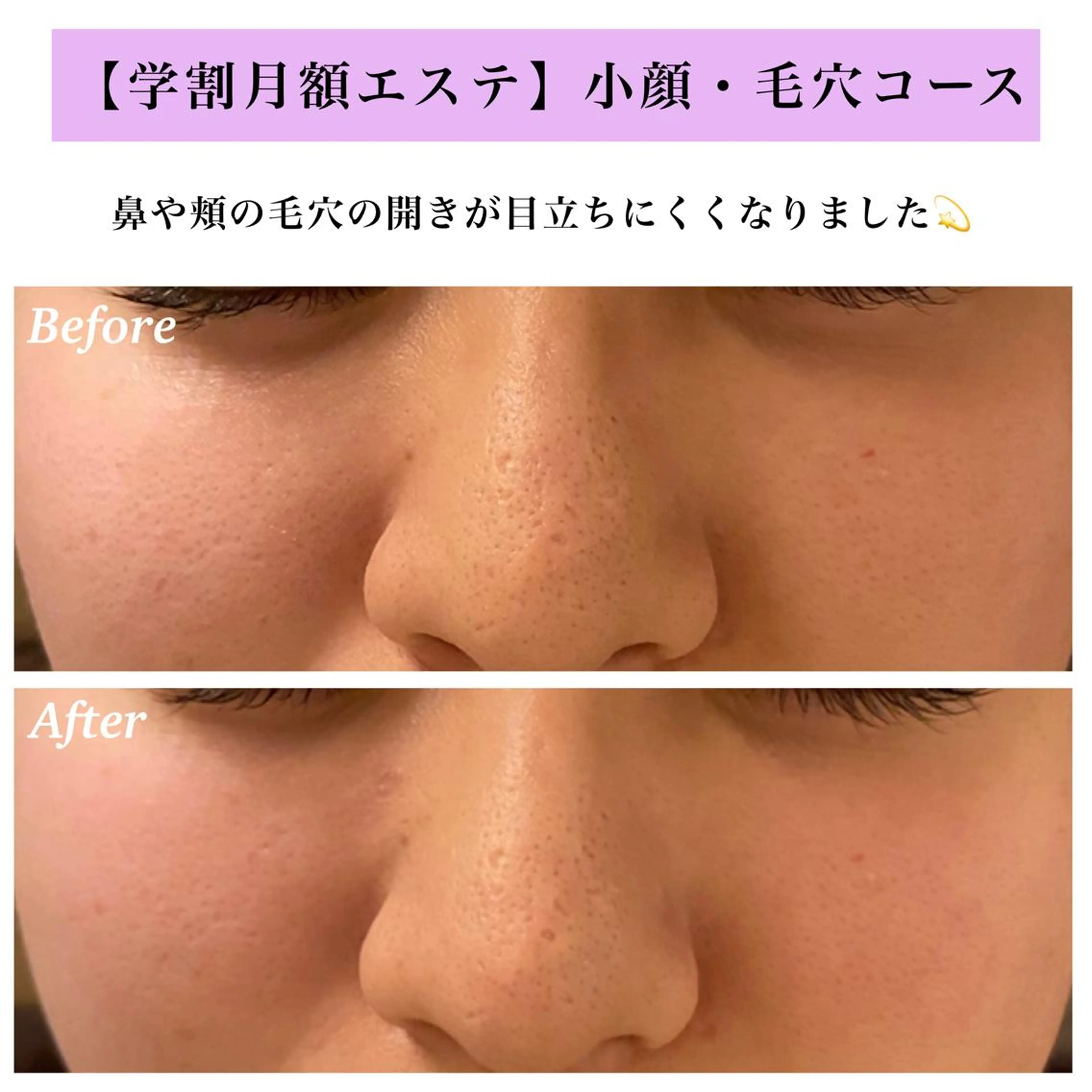 Bellesthe （ベルエステ）のエステ・リラクイメージ