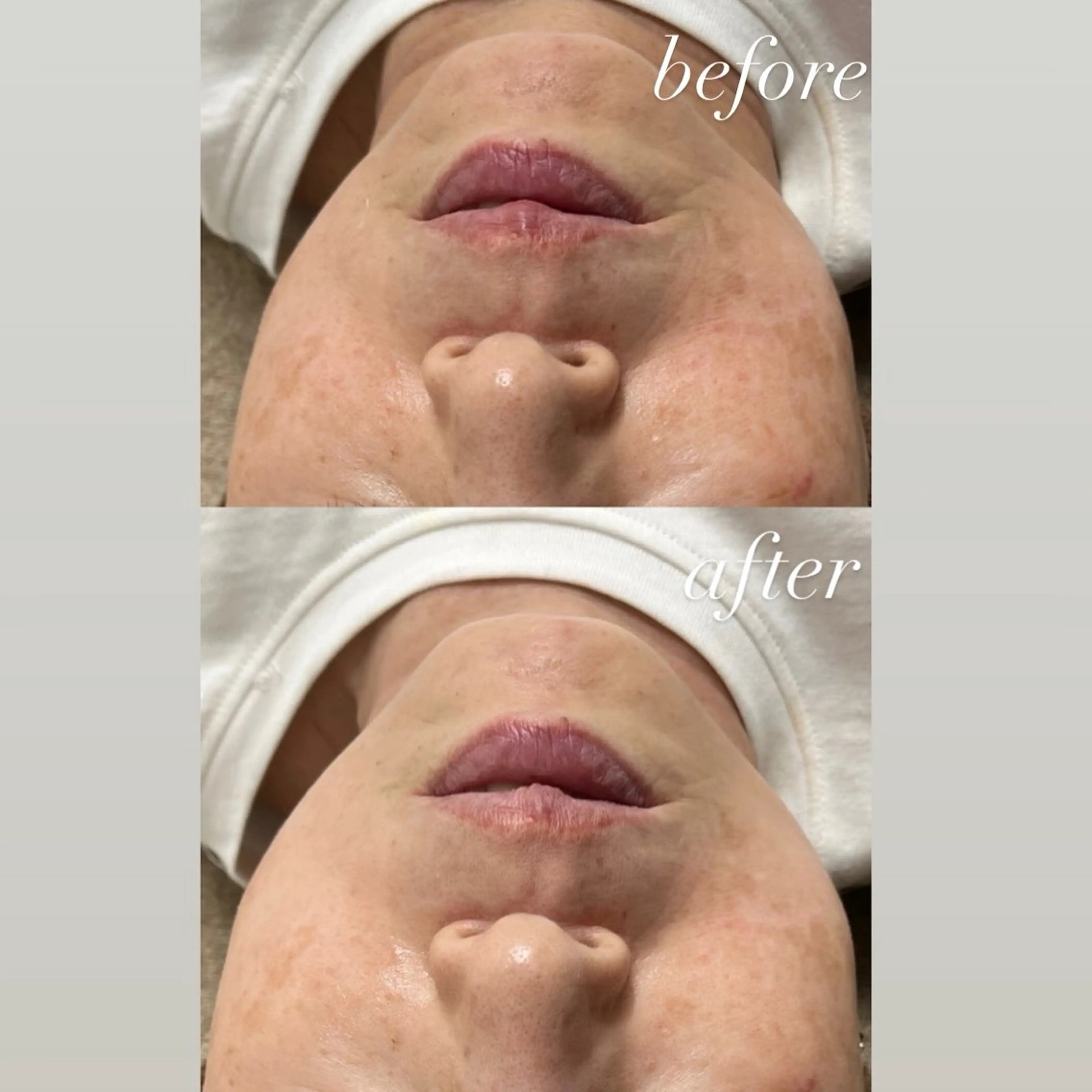 その他 smileskin 京都／meguのその他イメージ