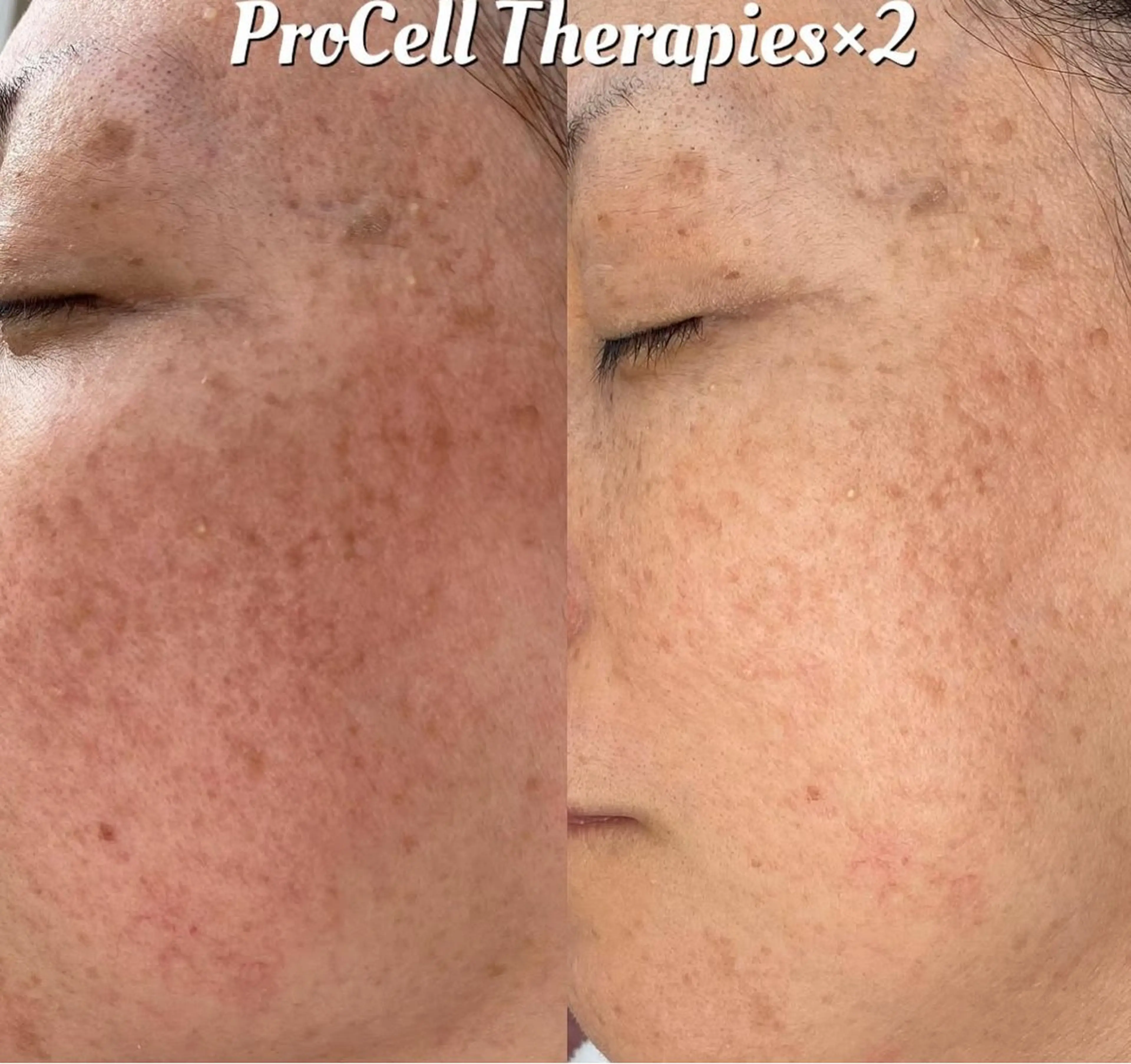 LOUISE. ／肌質・頭皮のエステ・リラクイメージ