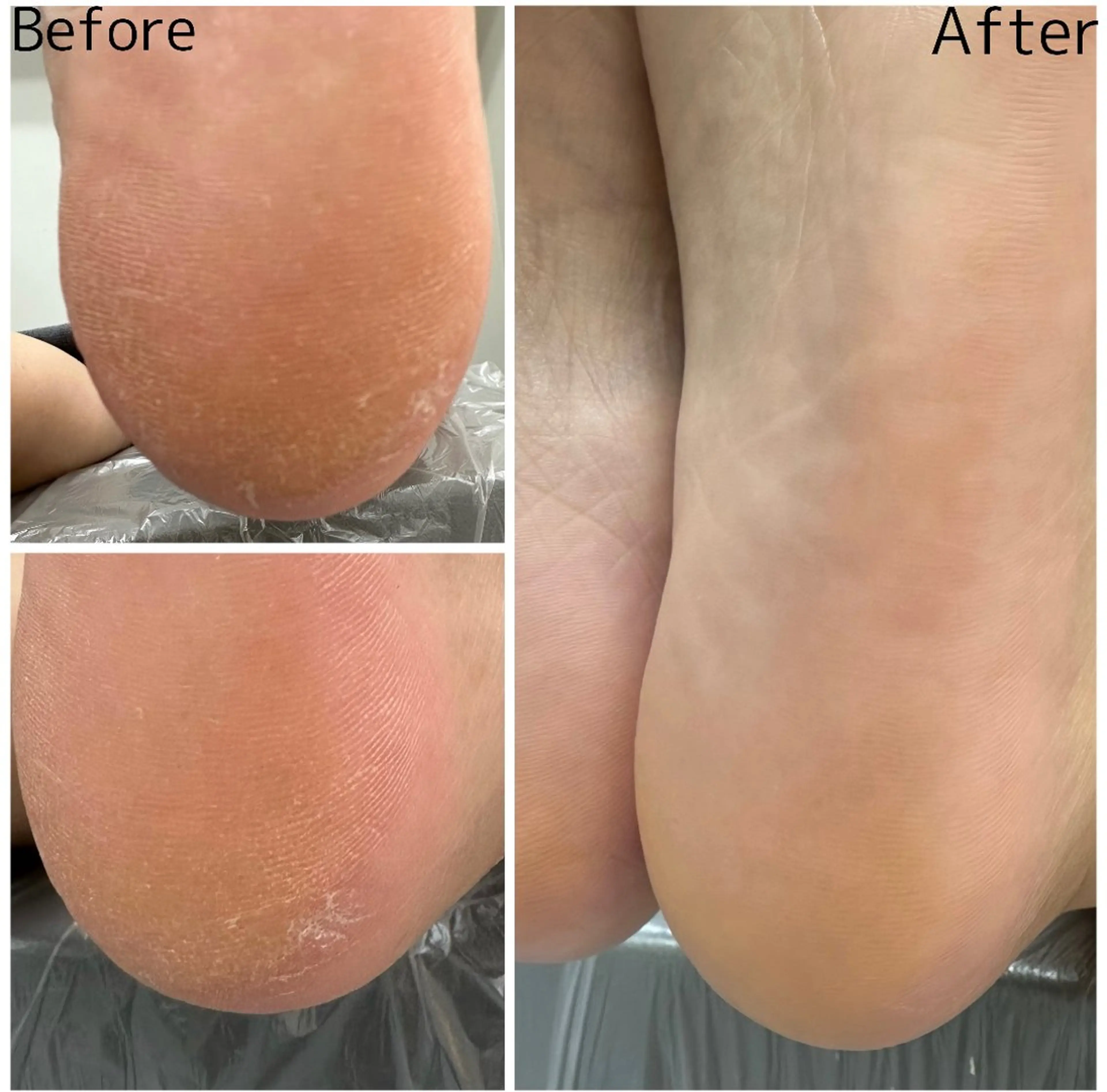 その他 松田 由紀のマツエク・マツパデザイン