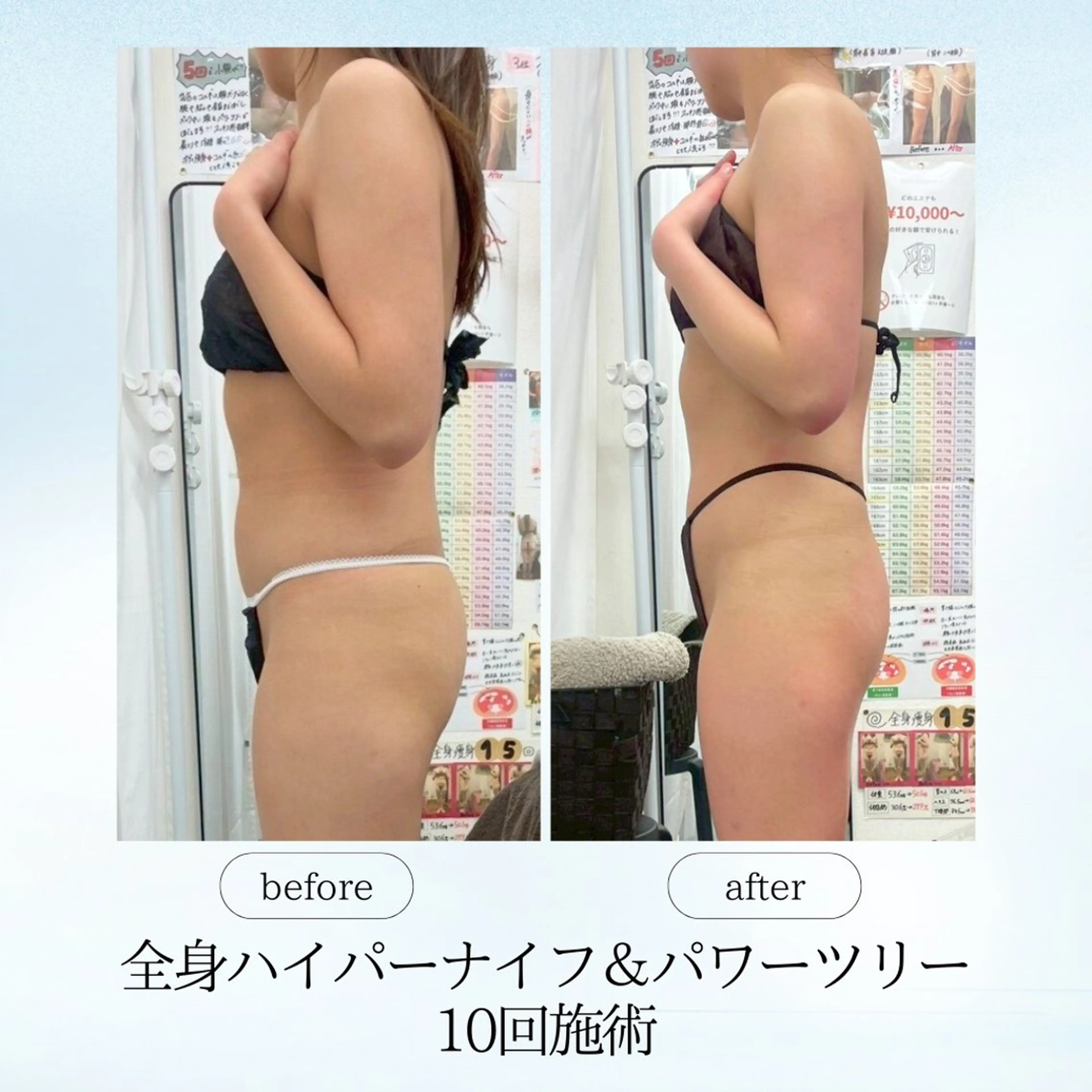 エステ リラク 《痩身、小顔専門店》 エスプレッソのエステ・リラクイメージ