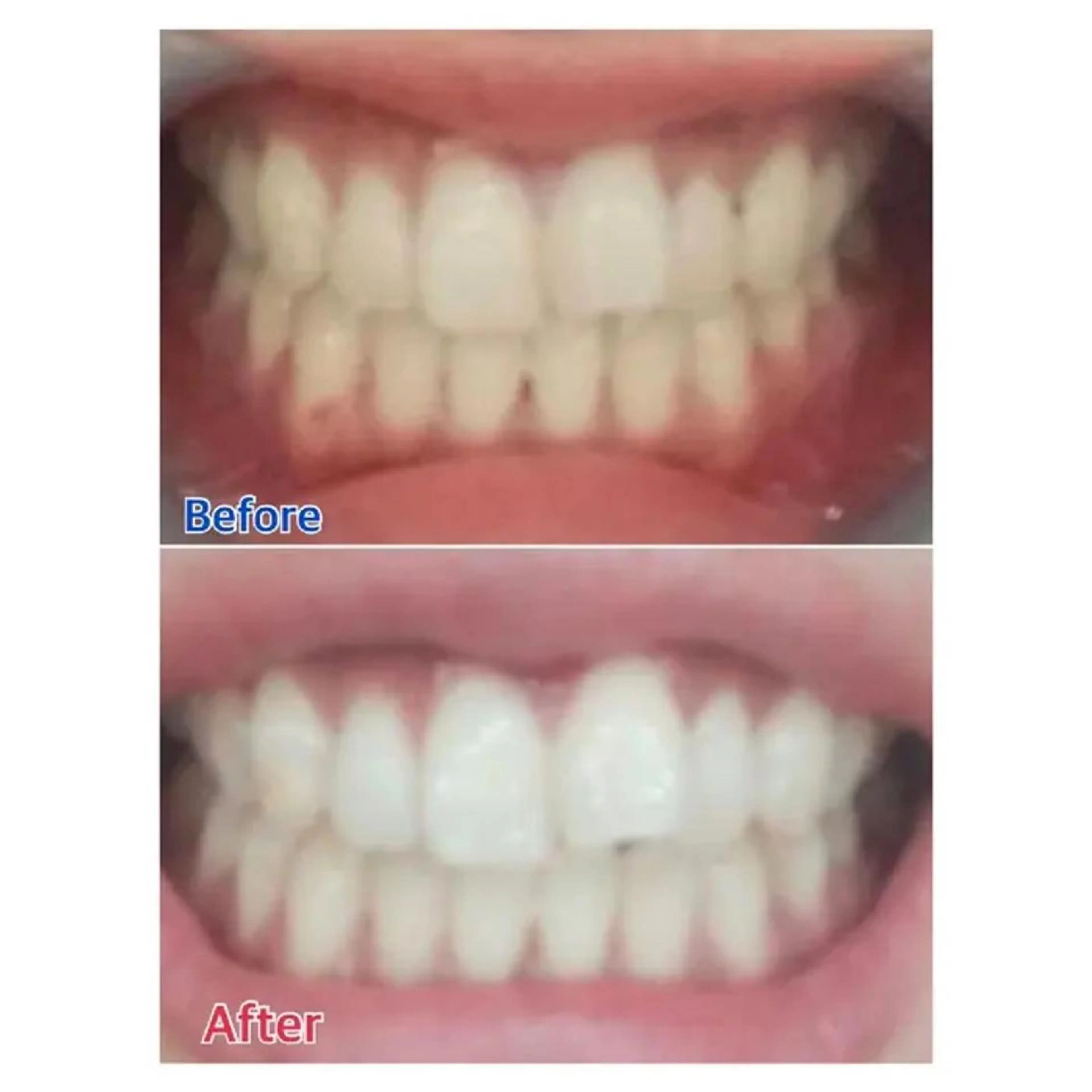 M渋谷 ホワイトニングのその他イメージ