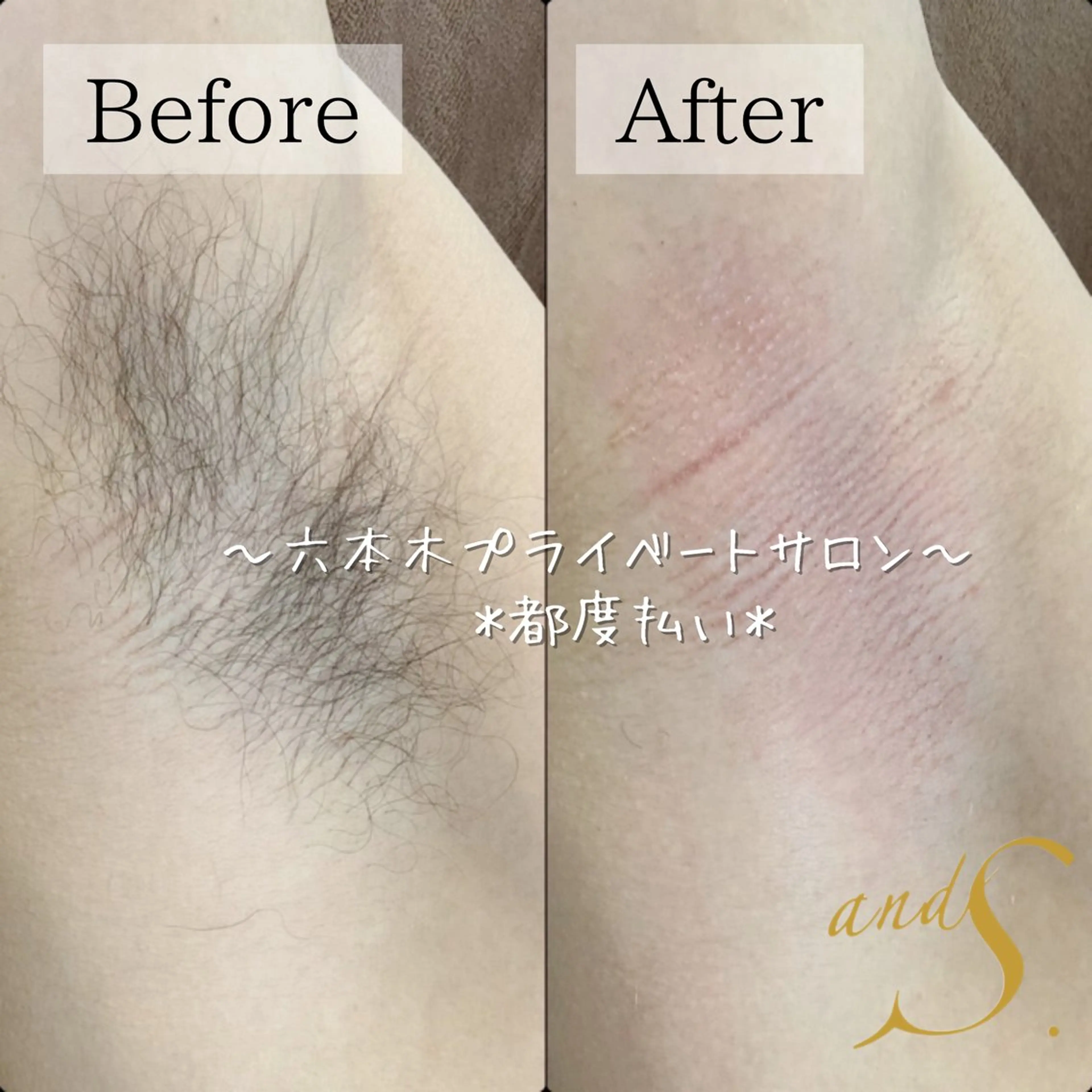 メンズ 脱毛 🌸🧡六本木 脱毛しずか🧡🫧の眉毛・アイブロウイメージ