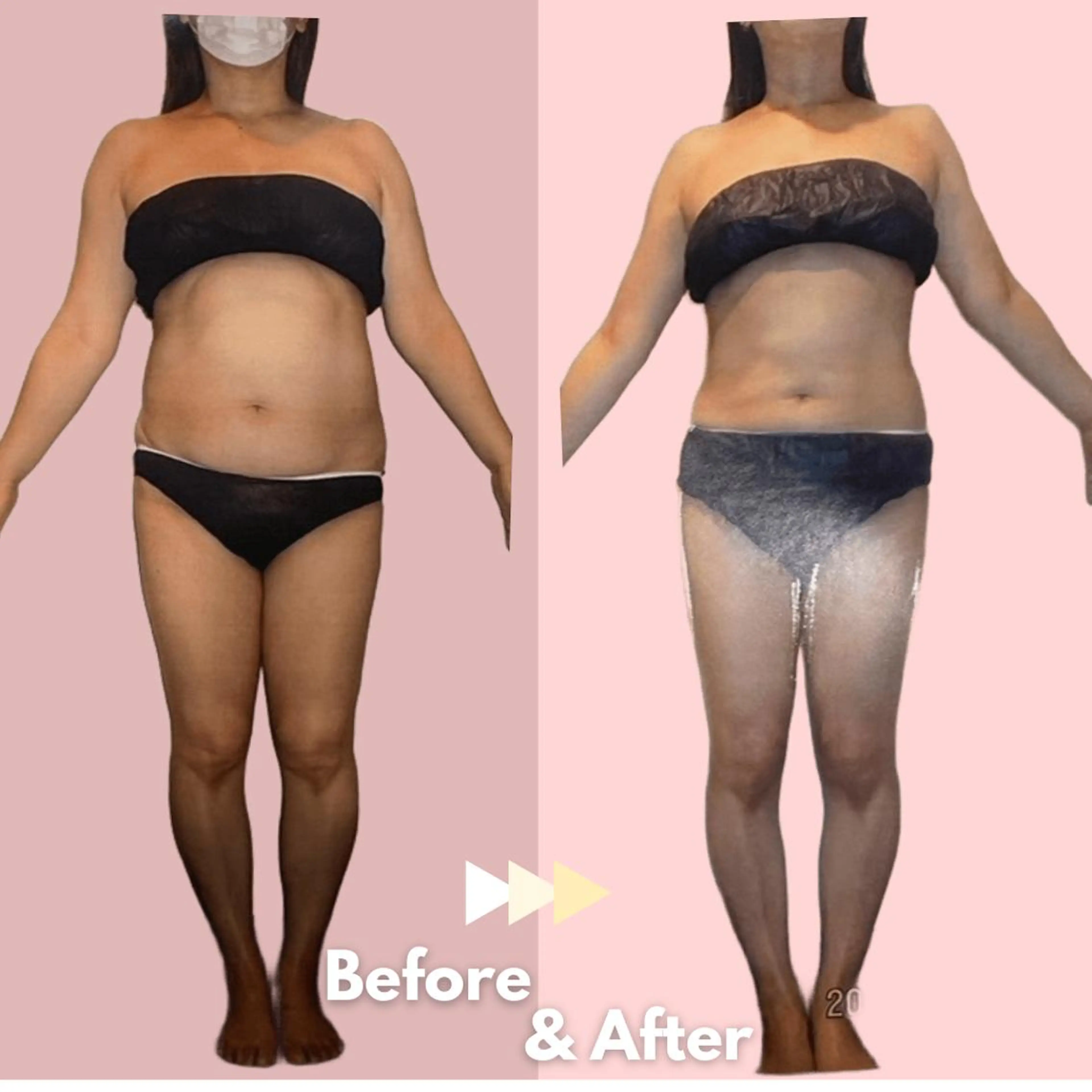 全身痩身✨ キレイサローネ横浜店のエステ・リラクイメージ