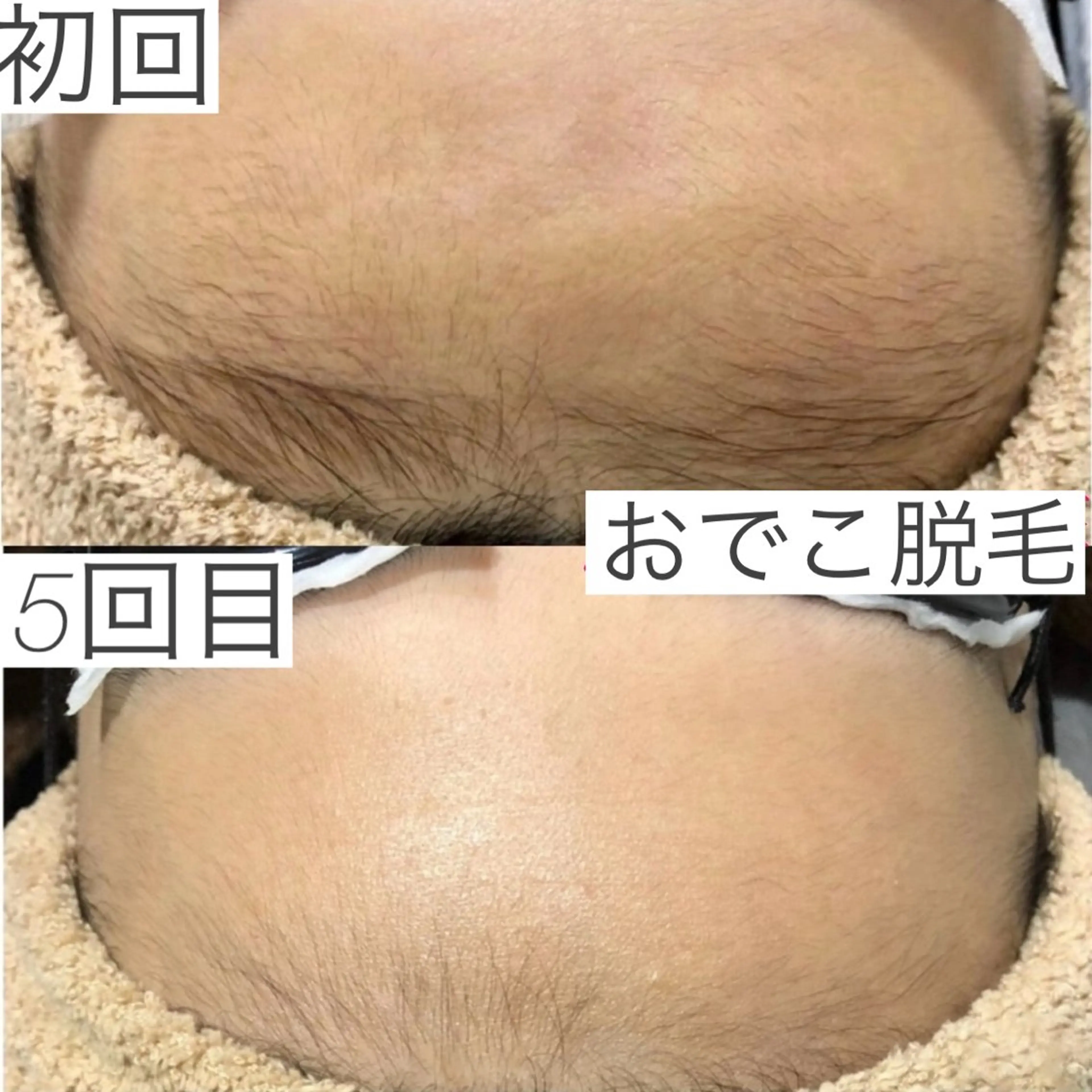 emiluca西目/ 脱毛/細胞美容のエステ・リラクイメージ