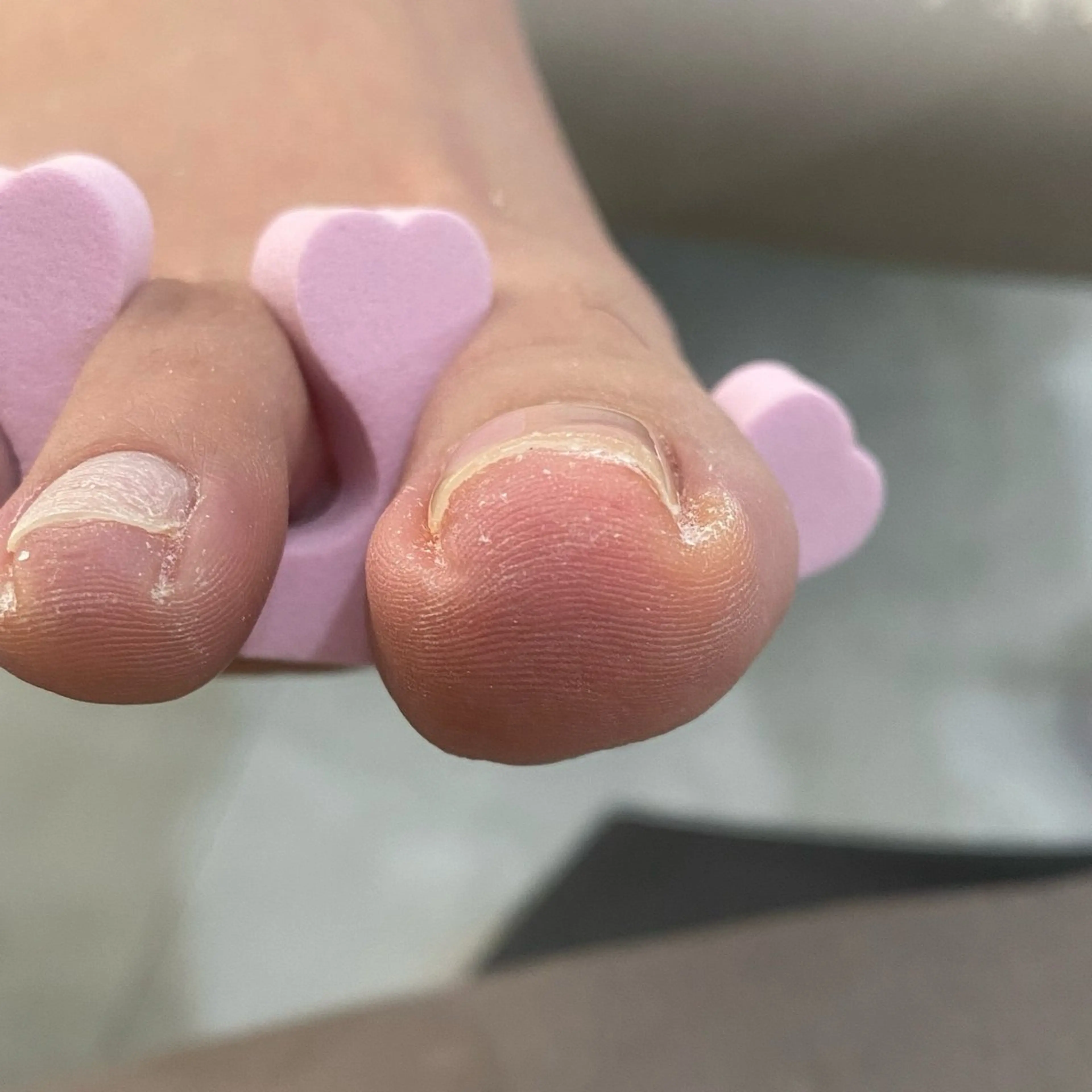 ネイル フットネイル SOL NAILのネイルデザイン